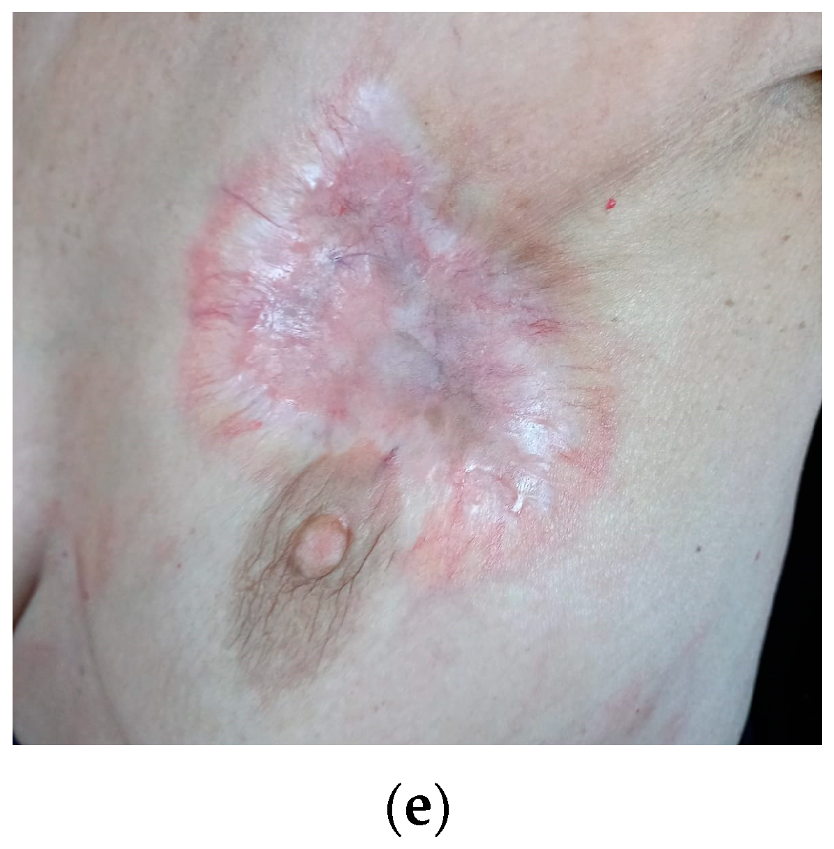 Curroncol 29 00756 g001b Curroncol 29 00756 g001b