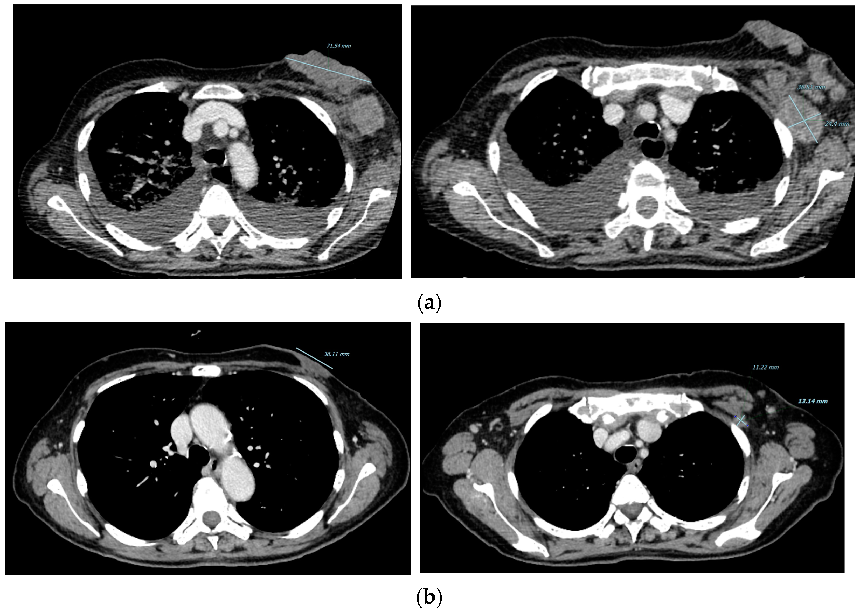 Curroncol 29 00756 g002 Curroncol 29 00756 g002