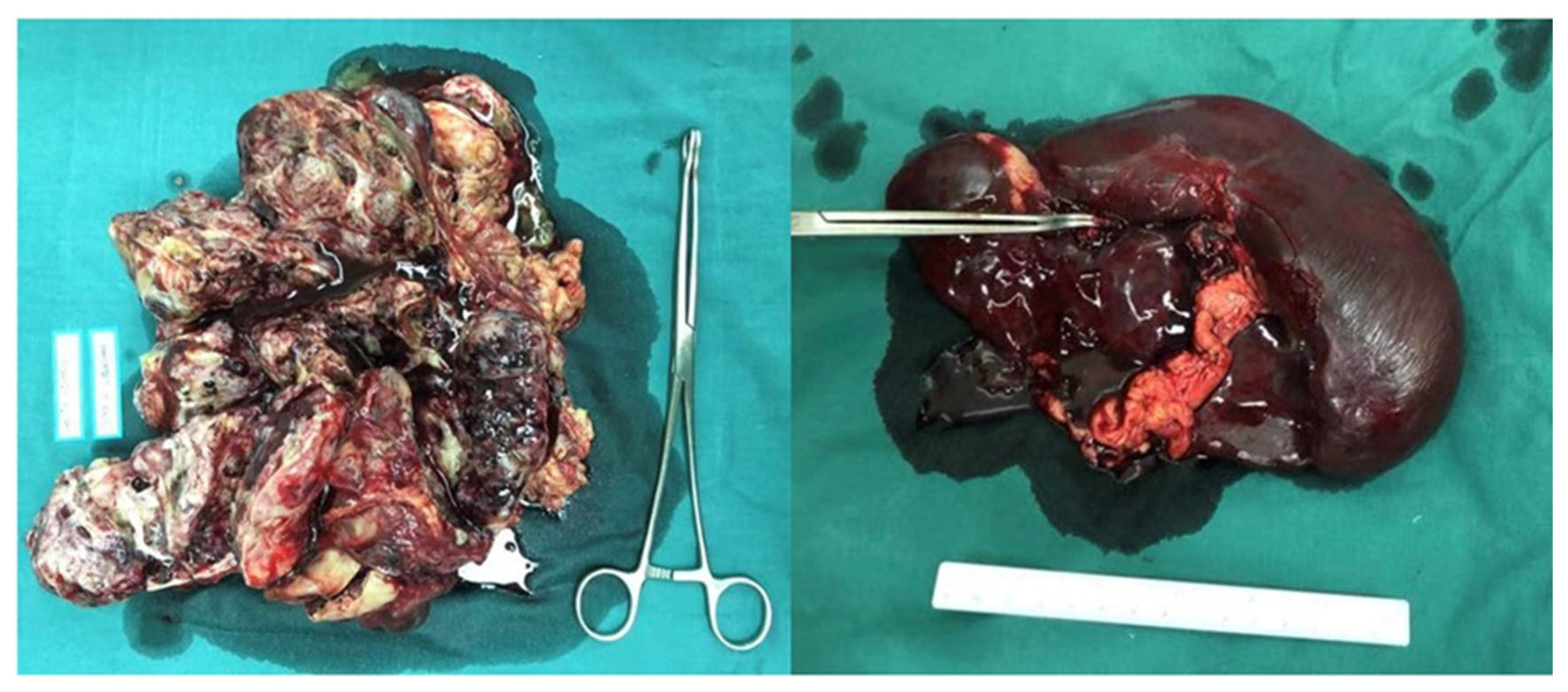 Curroncol 29 00766 g001