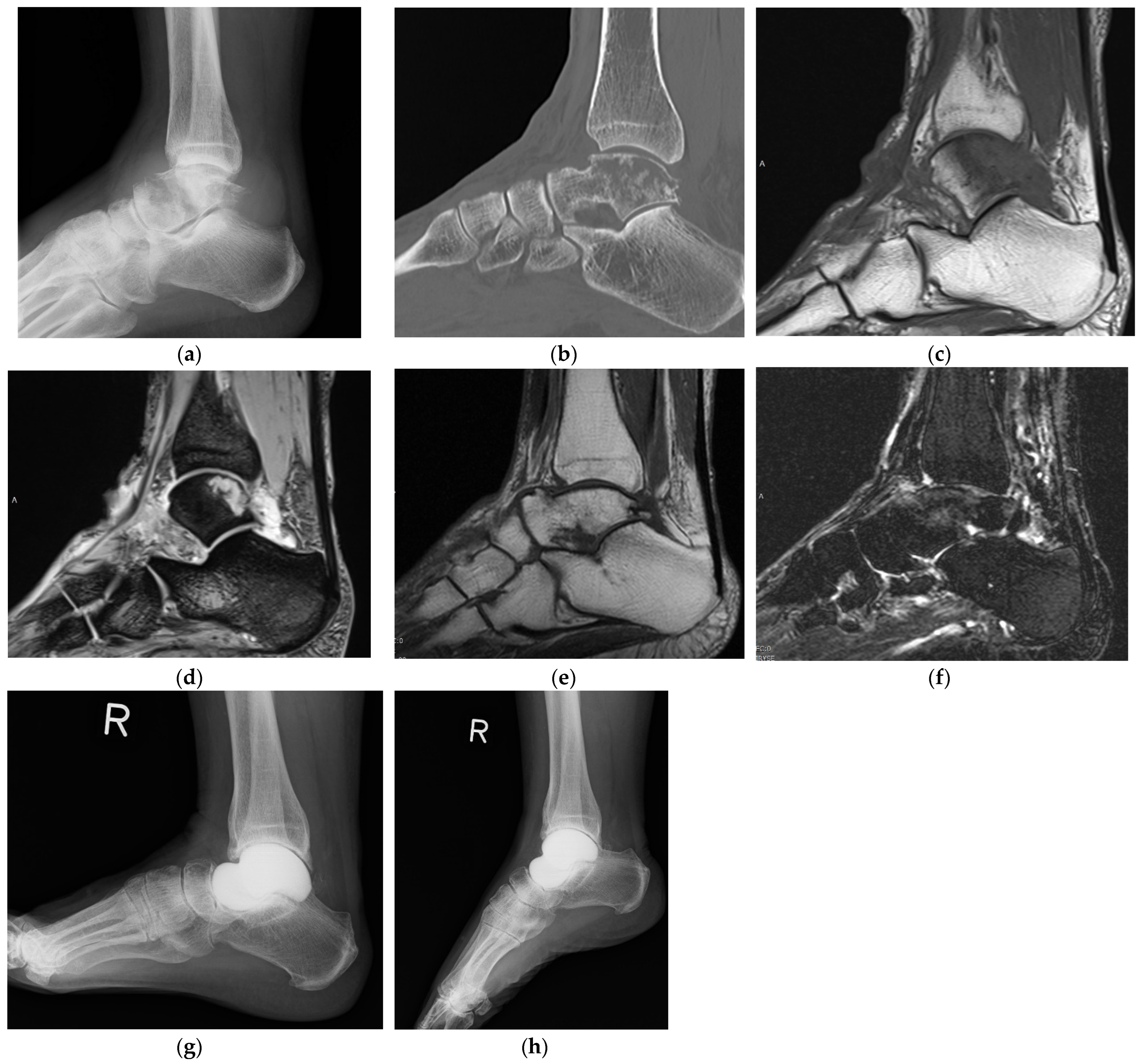 Curroncol 29 00769 g002 Curroncol 29 00769 g002