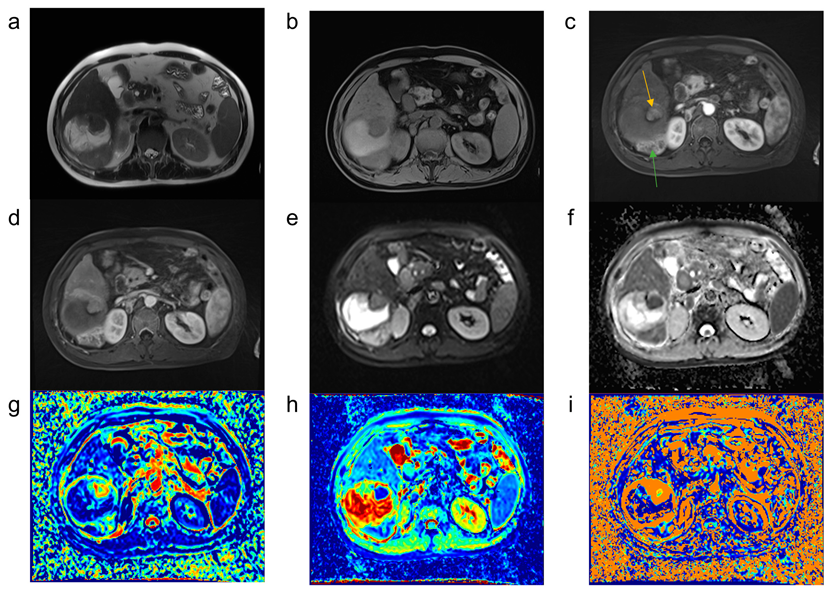 Curroncol 29 00774 g004