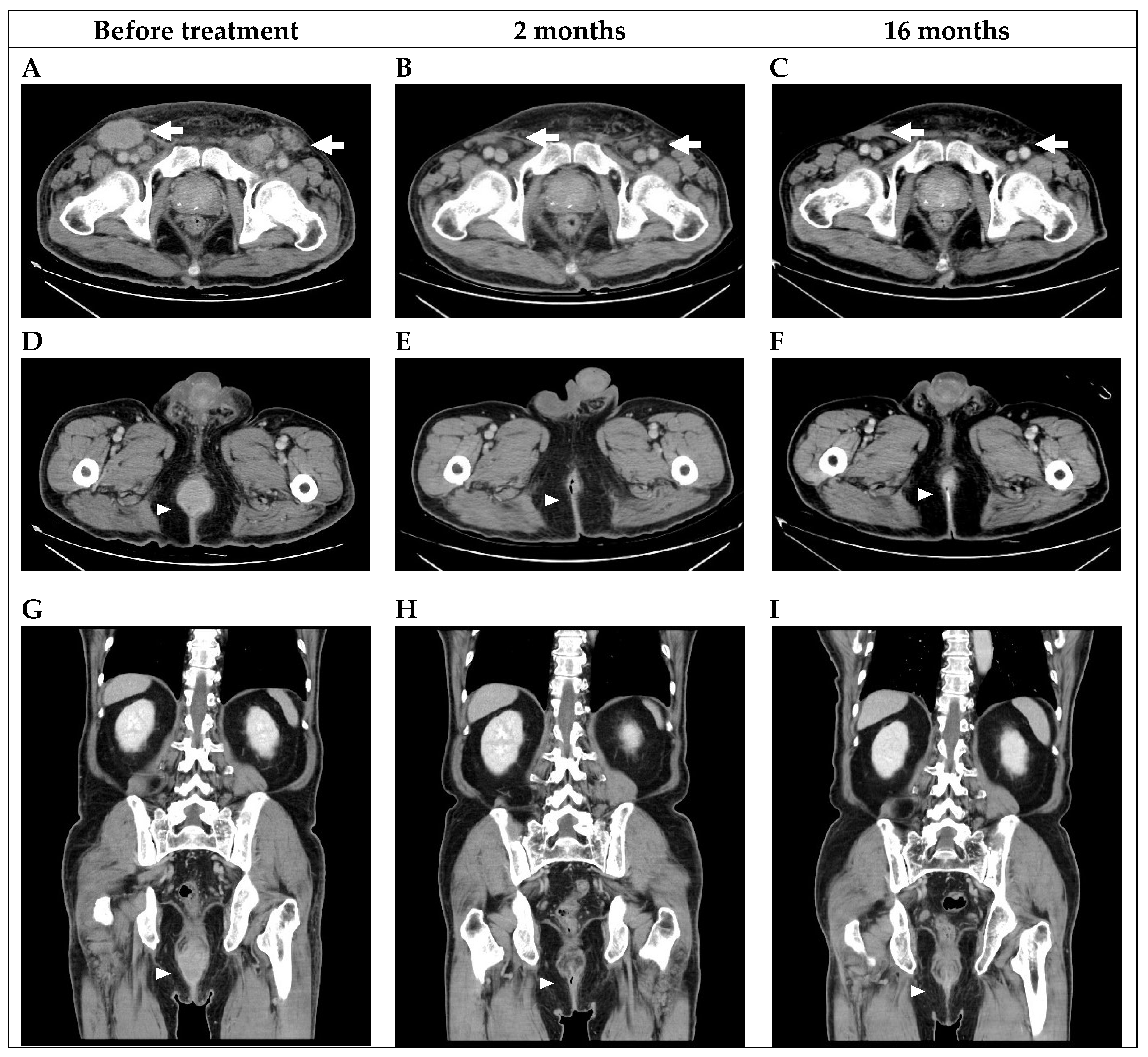 Curroncol 30 00026 g002