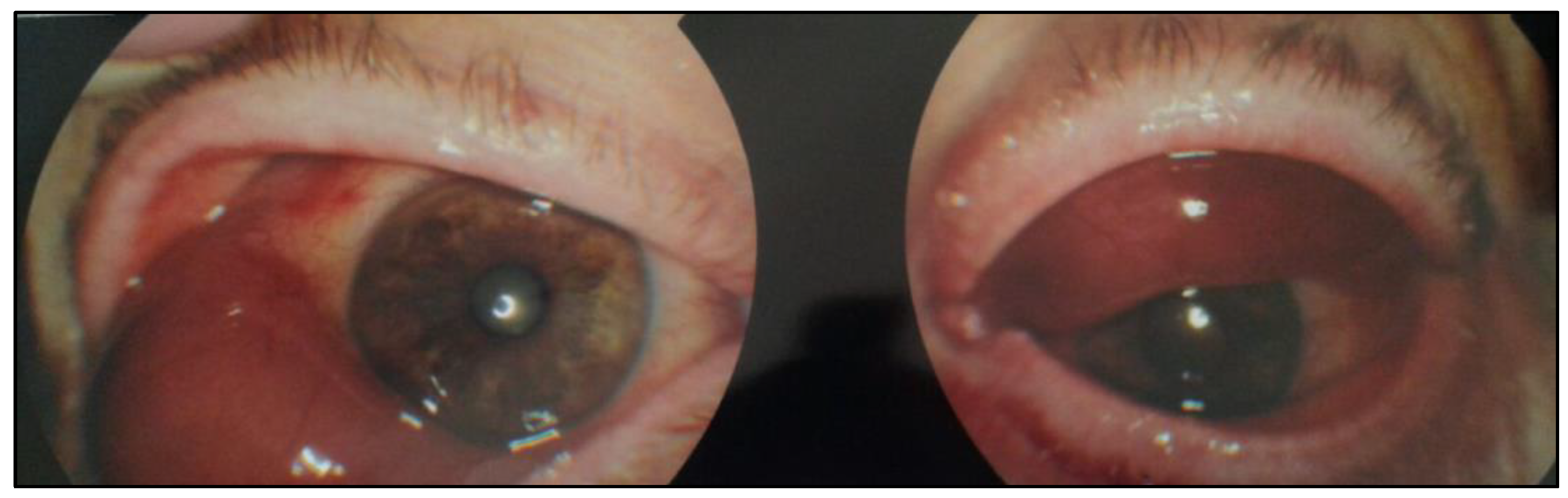 Curroncol 30 00062 g001 Curroncol 30 00062 g001