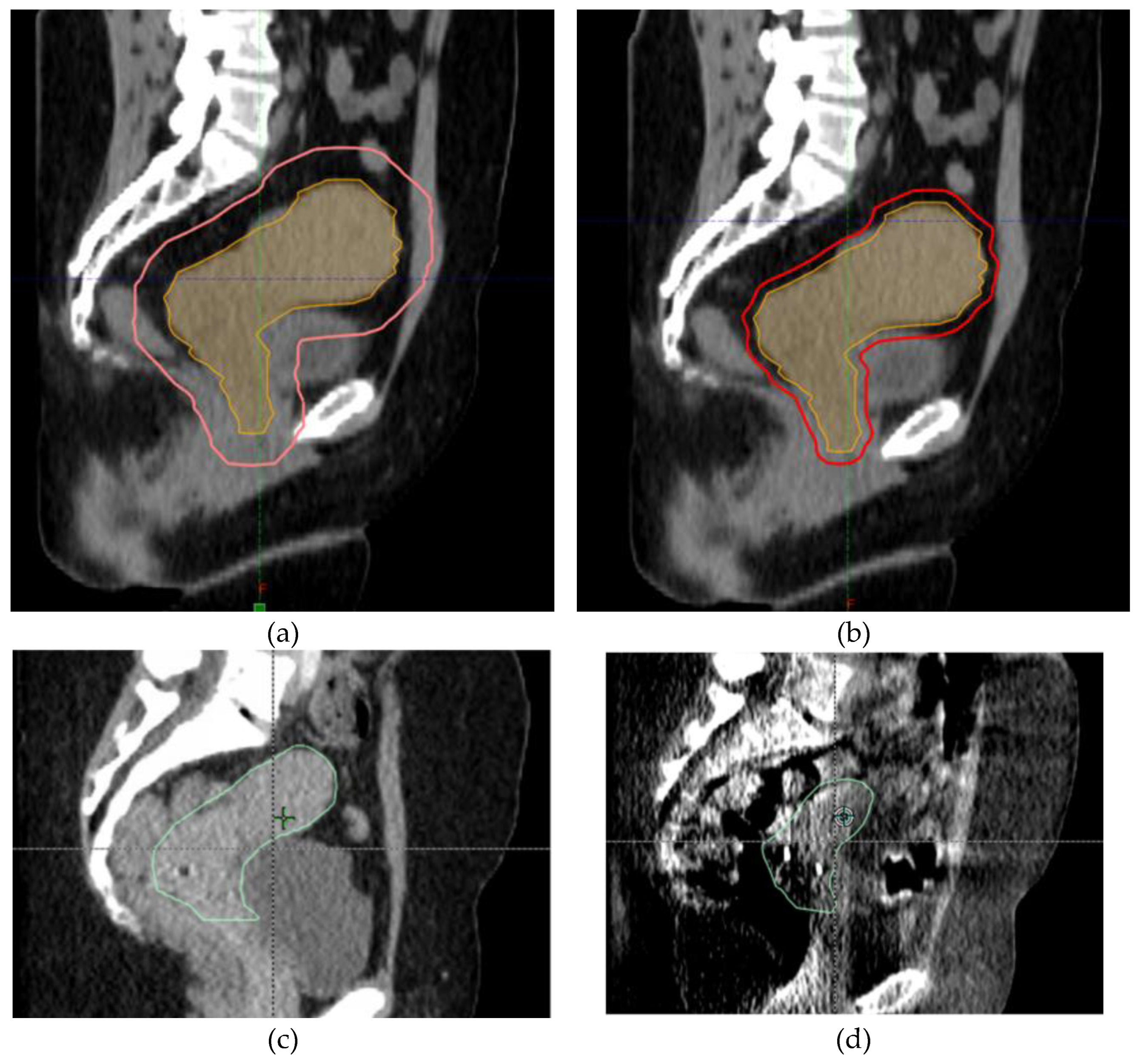 Curroncol 30 00066 g003
