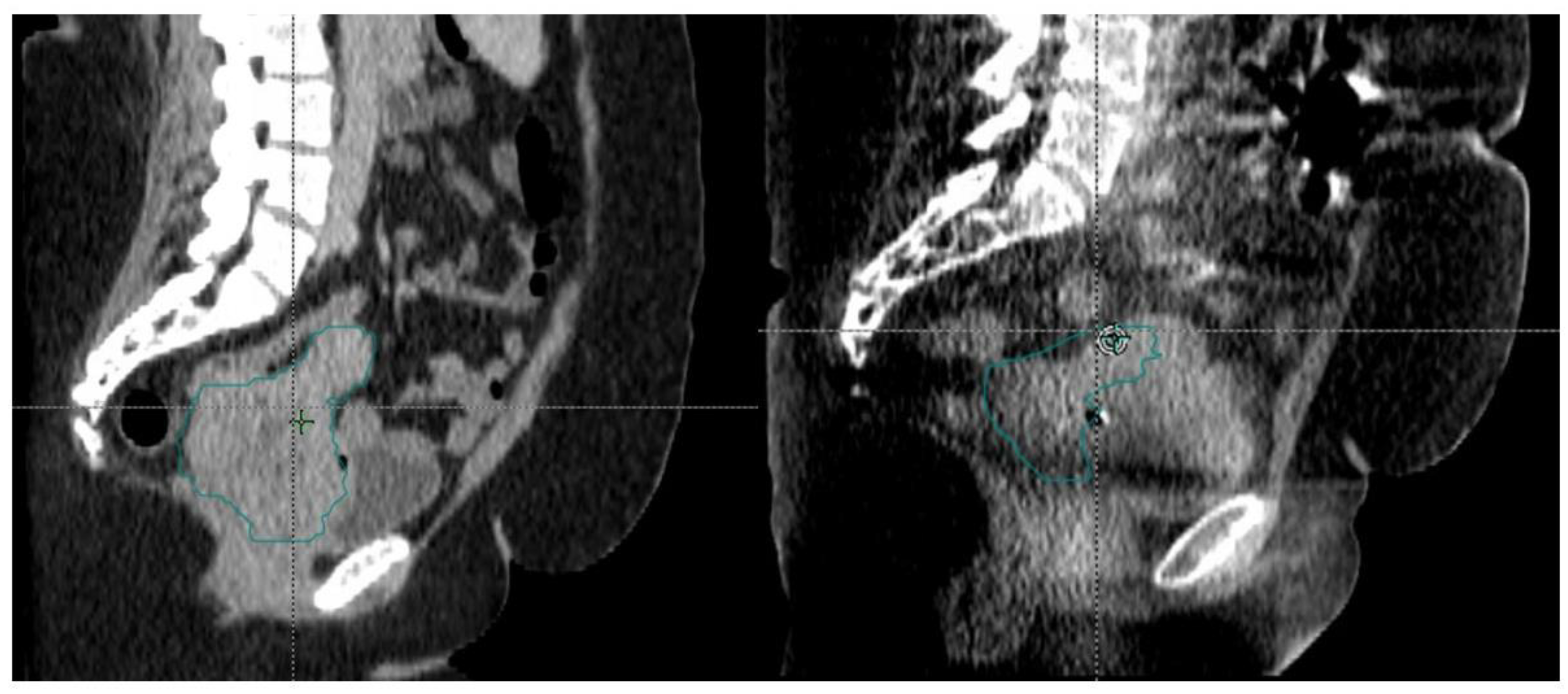 Curroncol 30 00066 g005