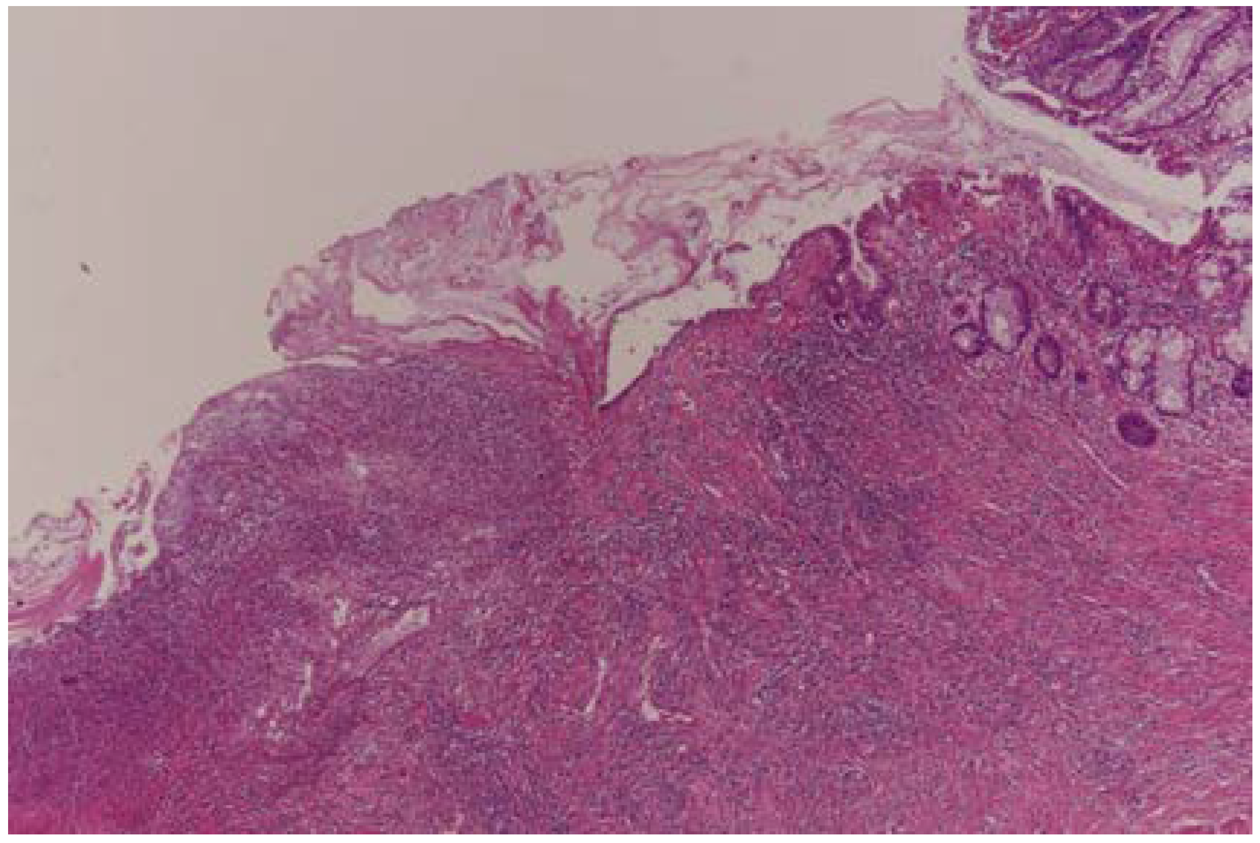 Curroncol 30 00081 g001 Curroncol 30 00081 g001