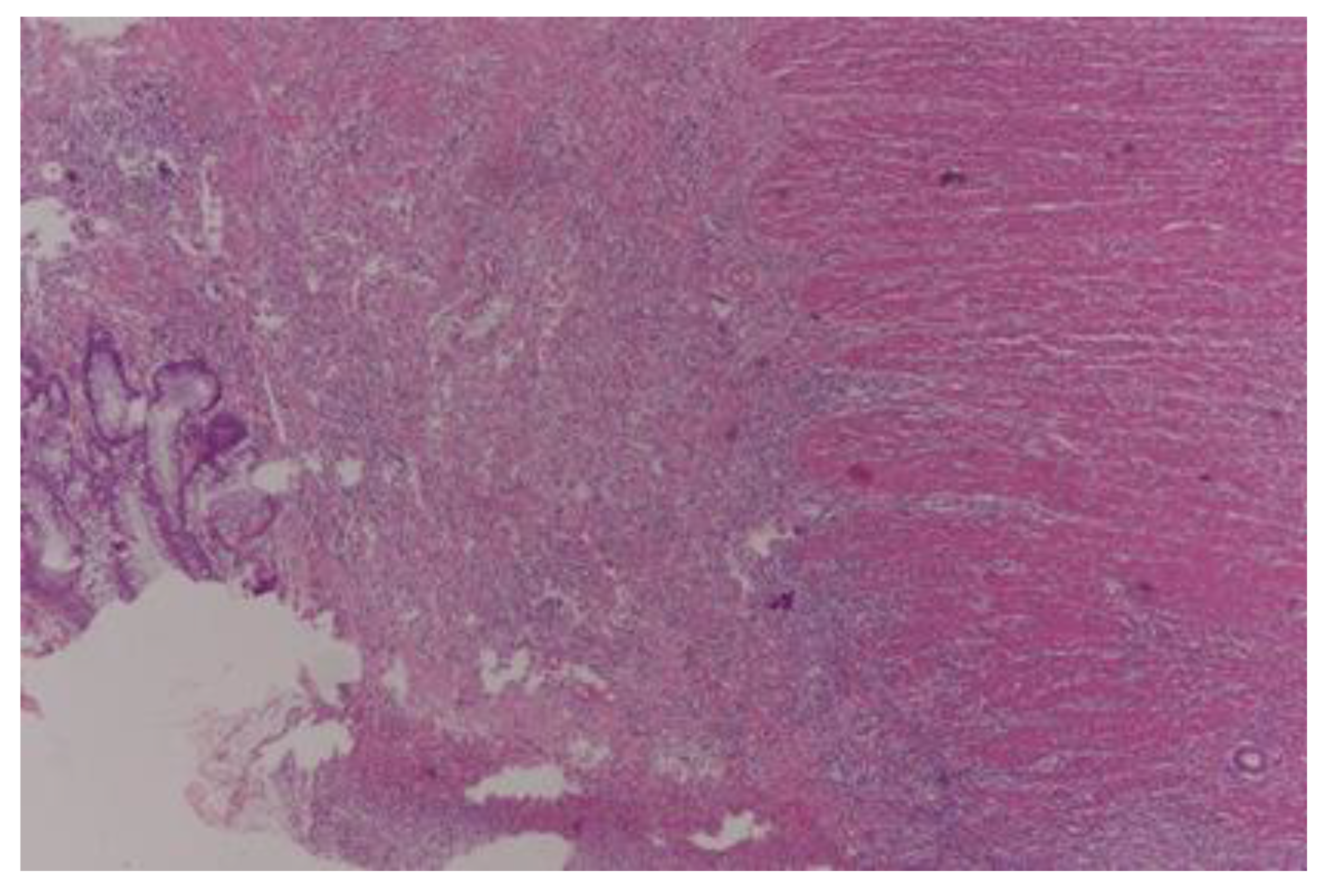 Curroncol 30 00081 g002 Curroncol 30 00081 g002