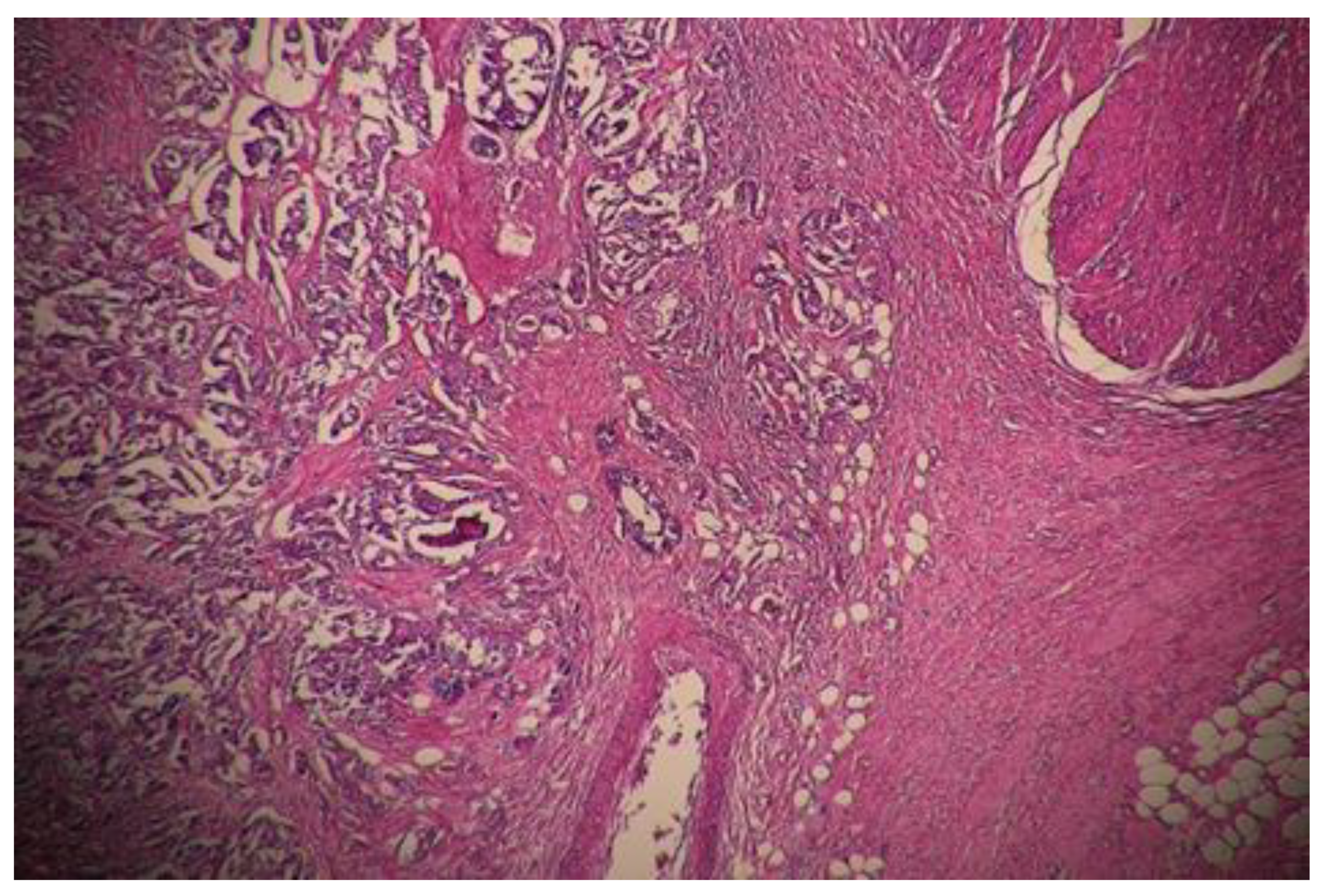 Curroncol 30 00081 g005 Curroncol 30 00081 g005