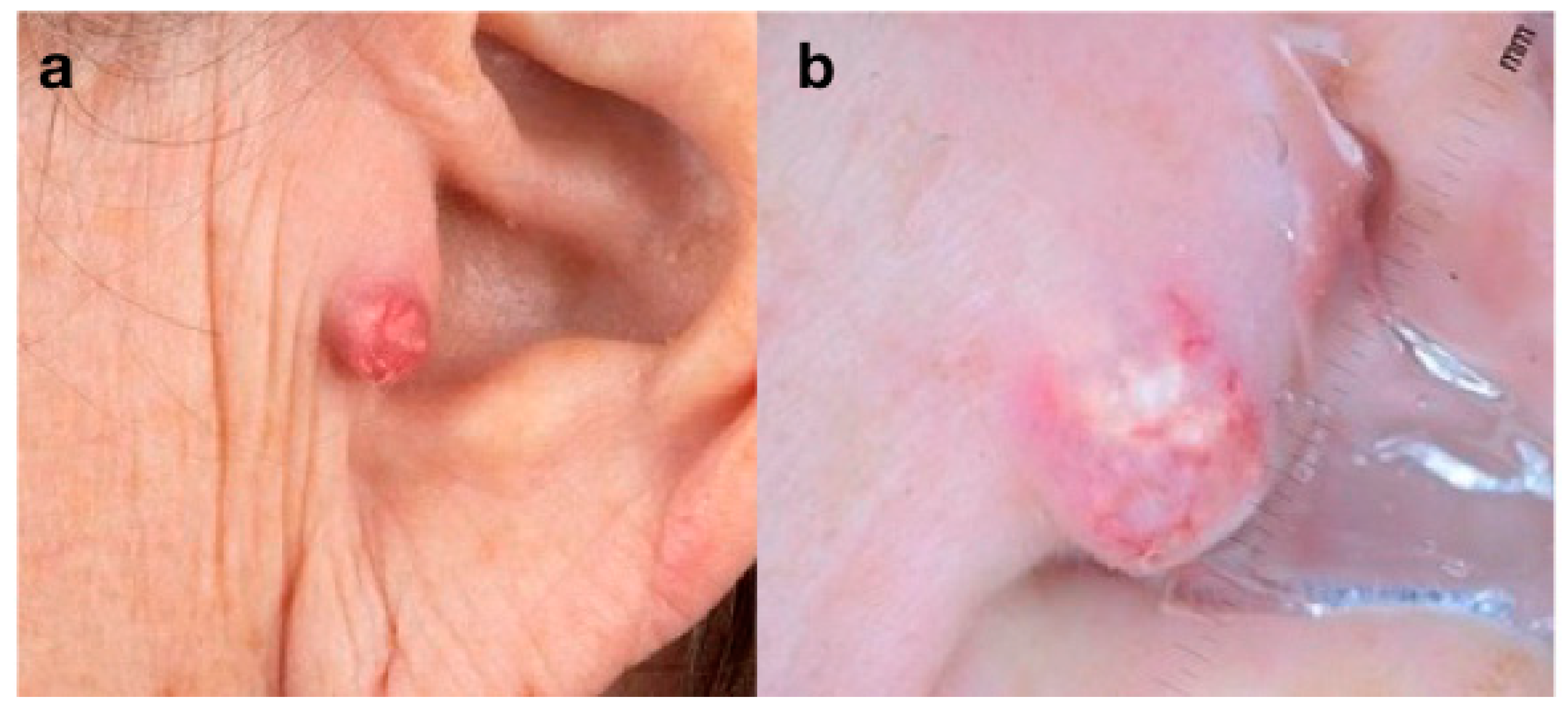 Curroncol 30 00109 g002 Curroncol 30 00109 g002