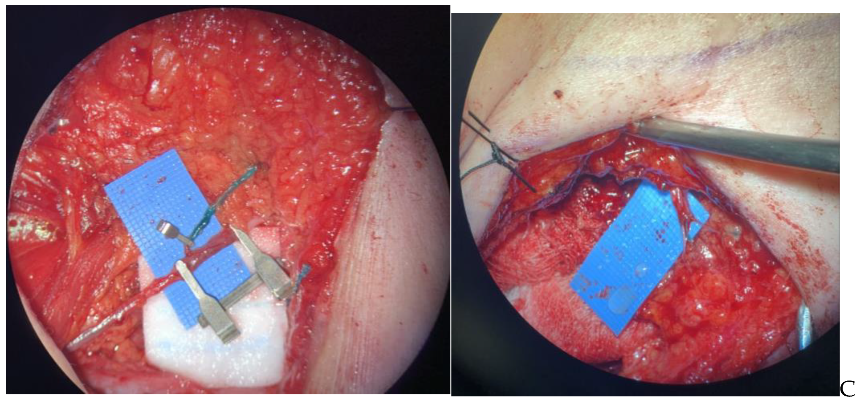 Curroncol 30 00119 g003b