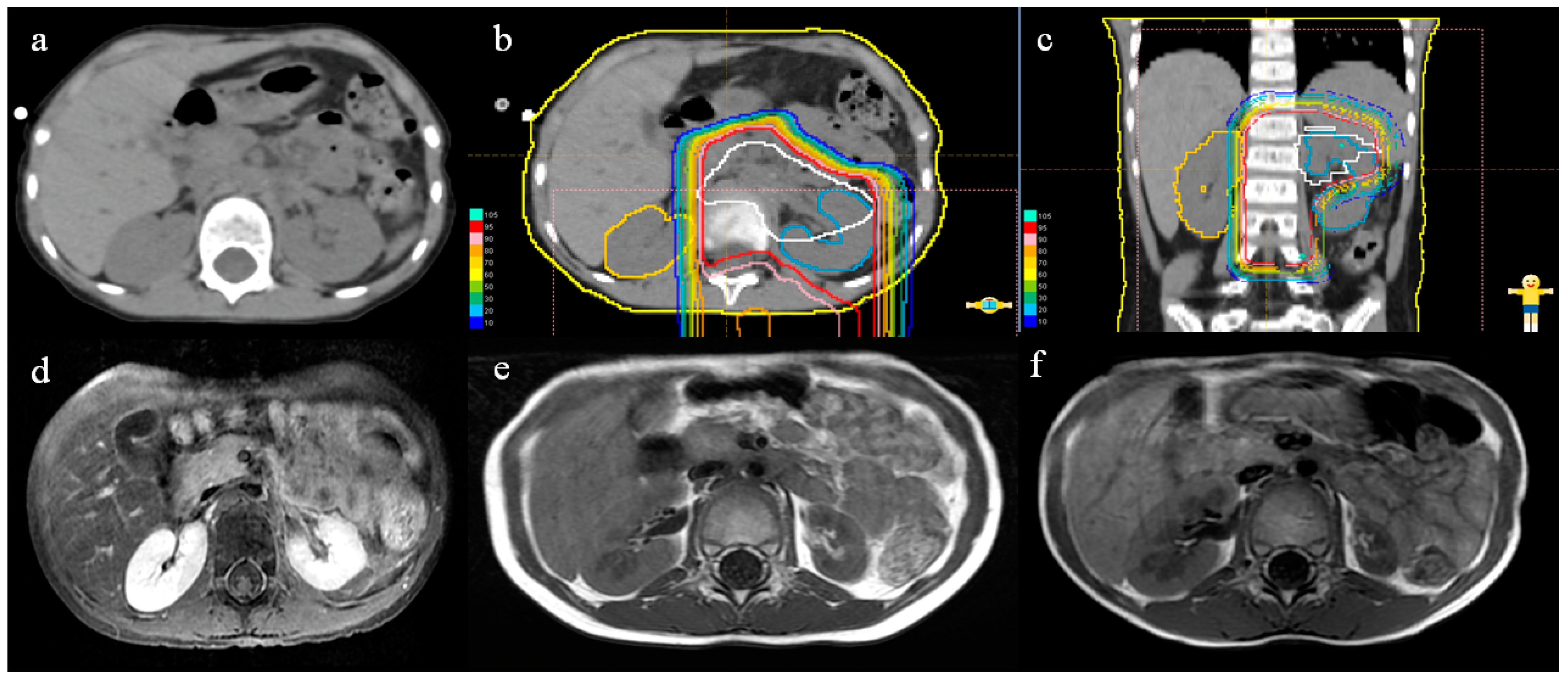 Curroncol 30 00120 g003 Curroncol 30 00120 g003