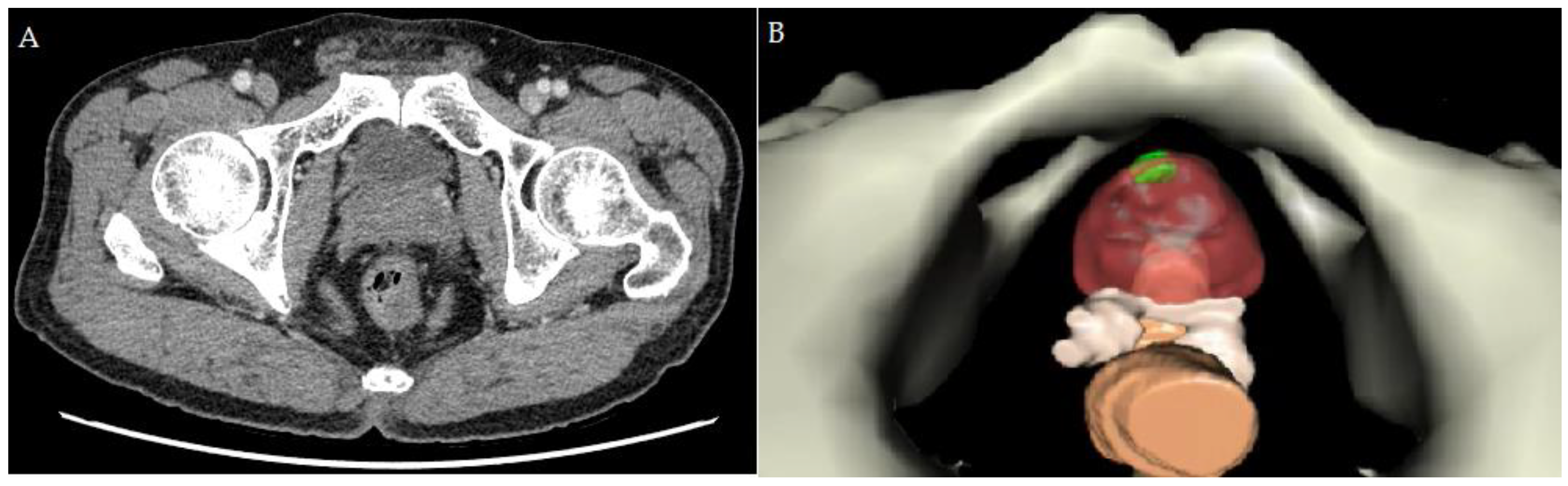 Curroncol 30 00131 g003 Curroncol 30 00131 g003
