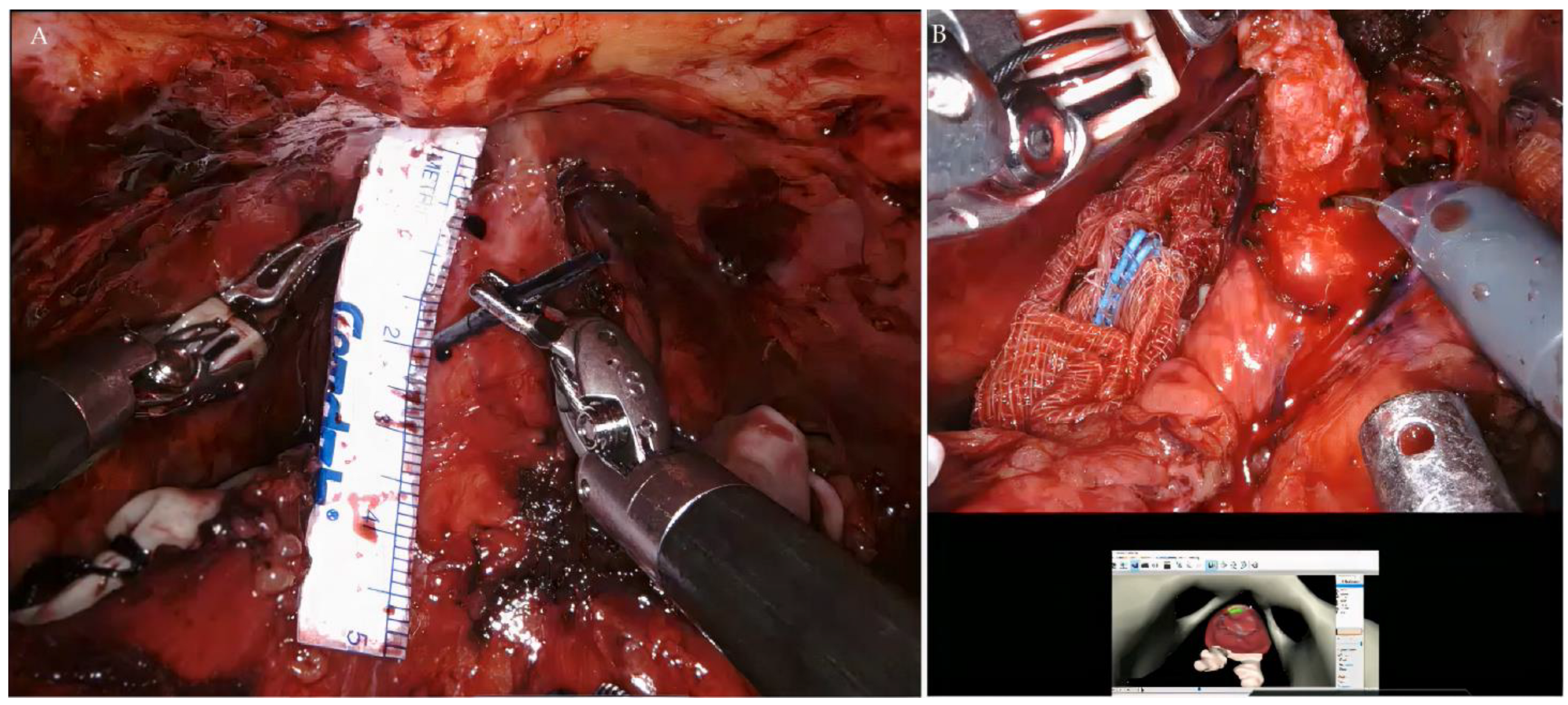 Curroncol 30 00131 g004 Curroncol 30 00131 g004