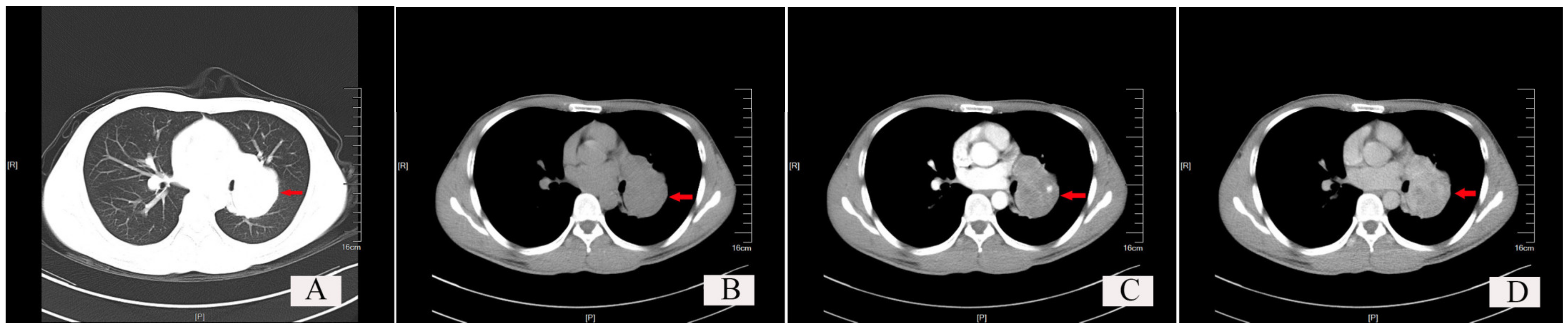 Curroncol 30 00138 g003