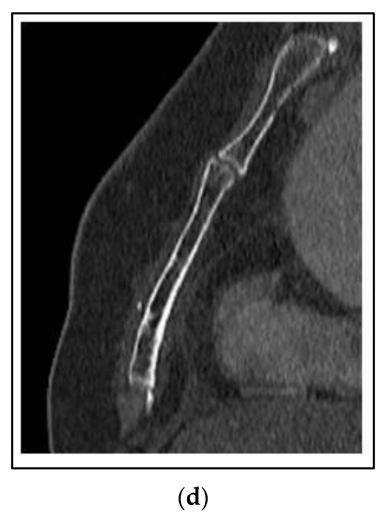 Curroncol 30 00192 g002b