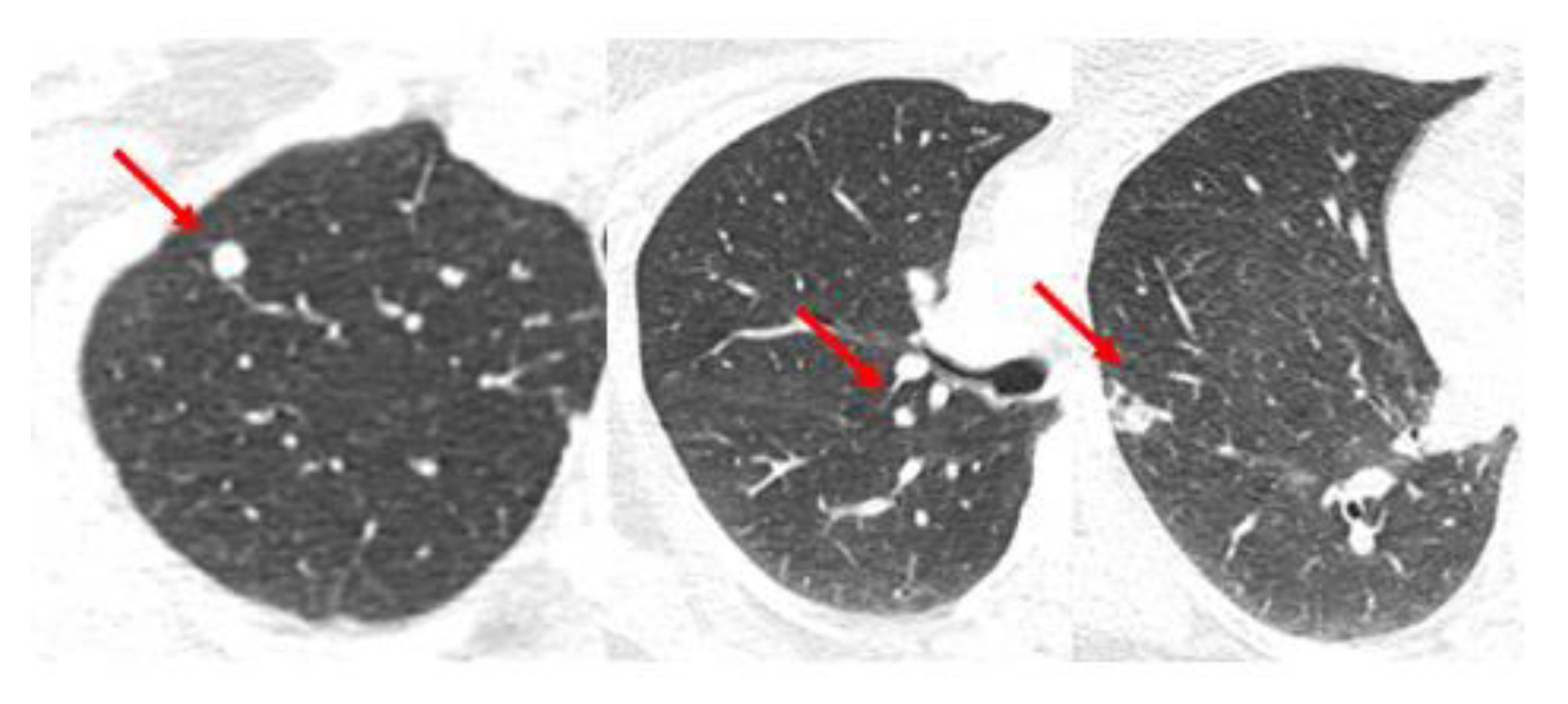 Curroncol 30 00192 g003