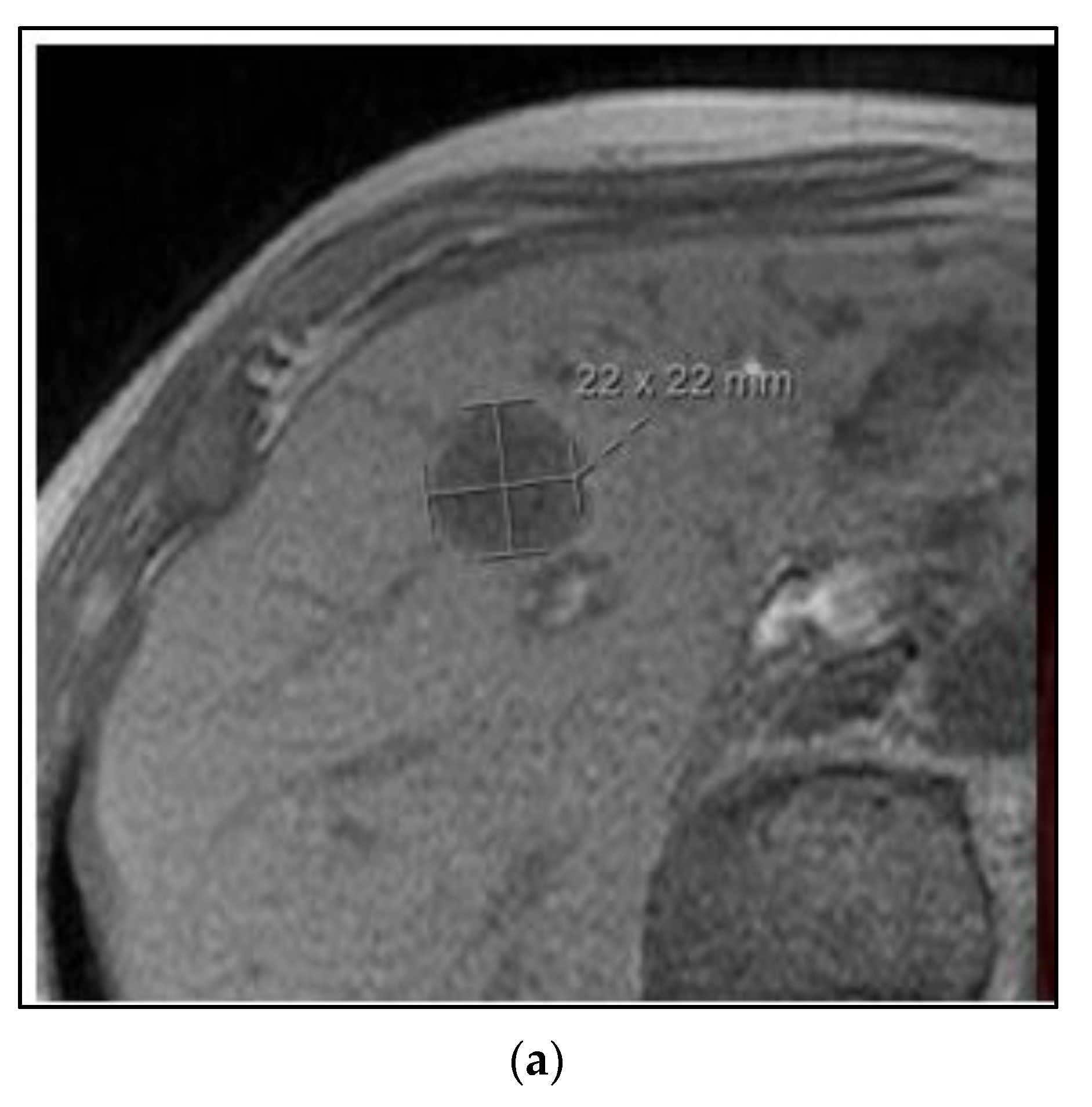 Curroncol 30 00192 g004a