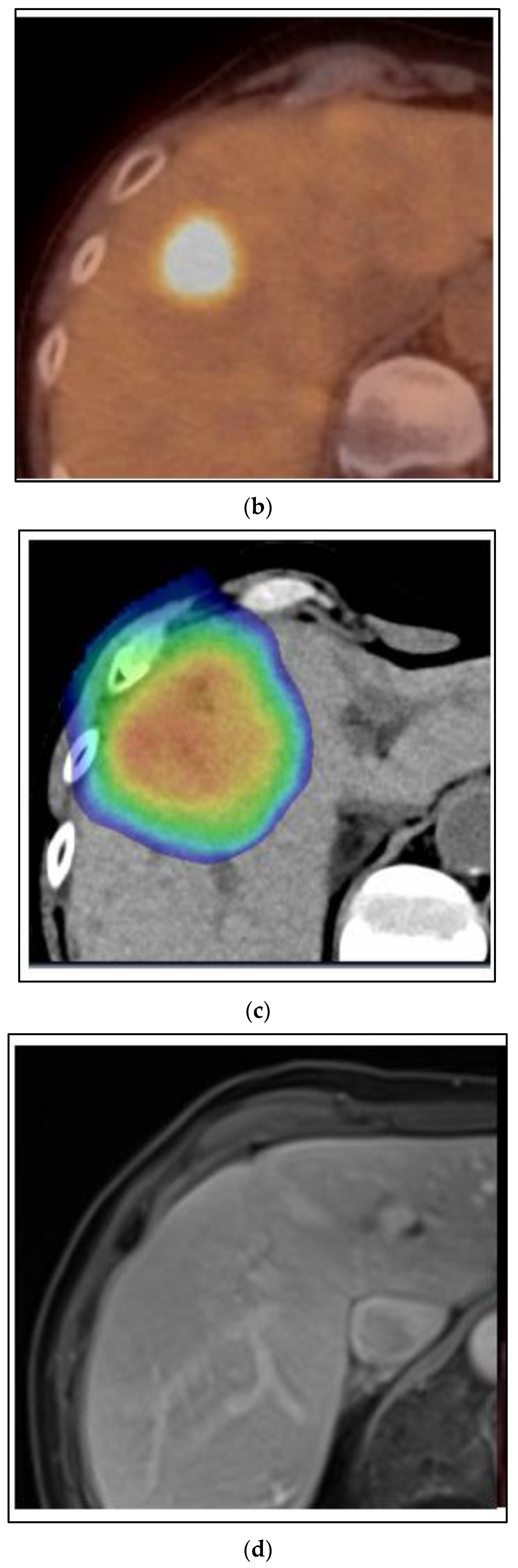 Curroncol 30 00192 g004b