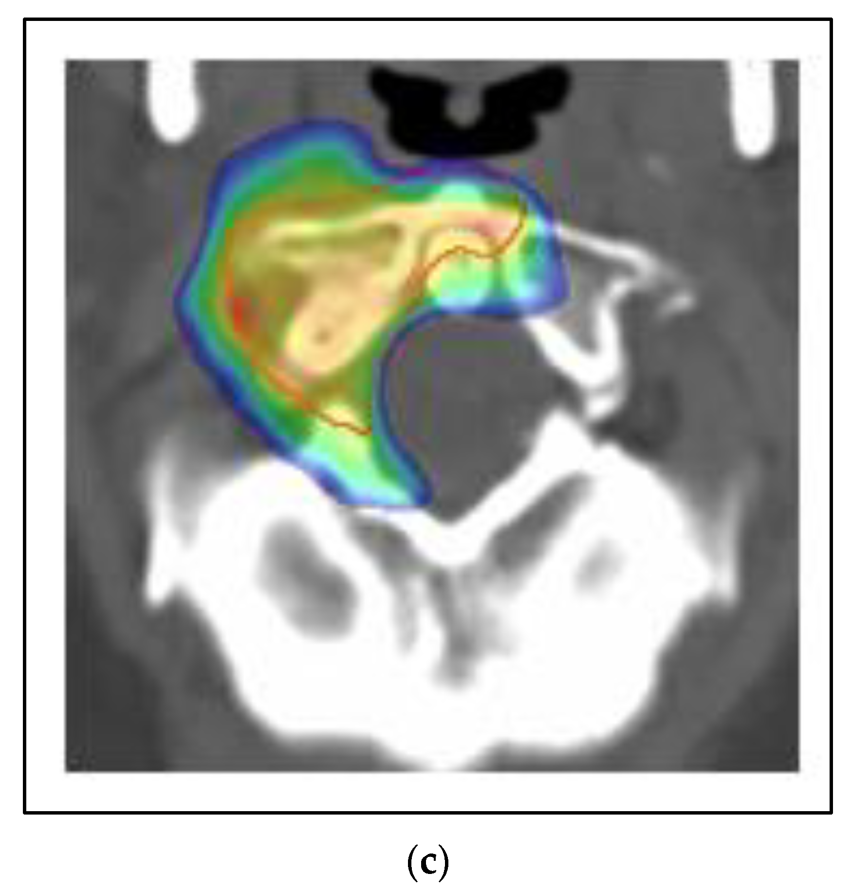 Curroncol 30 00192 g005b