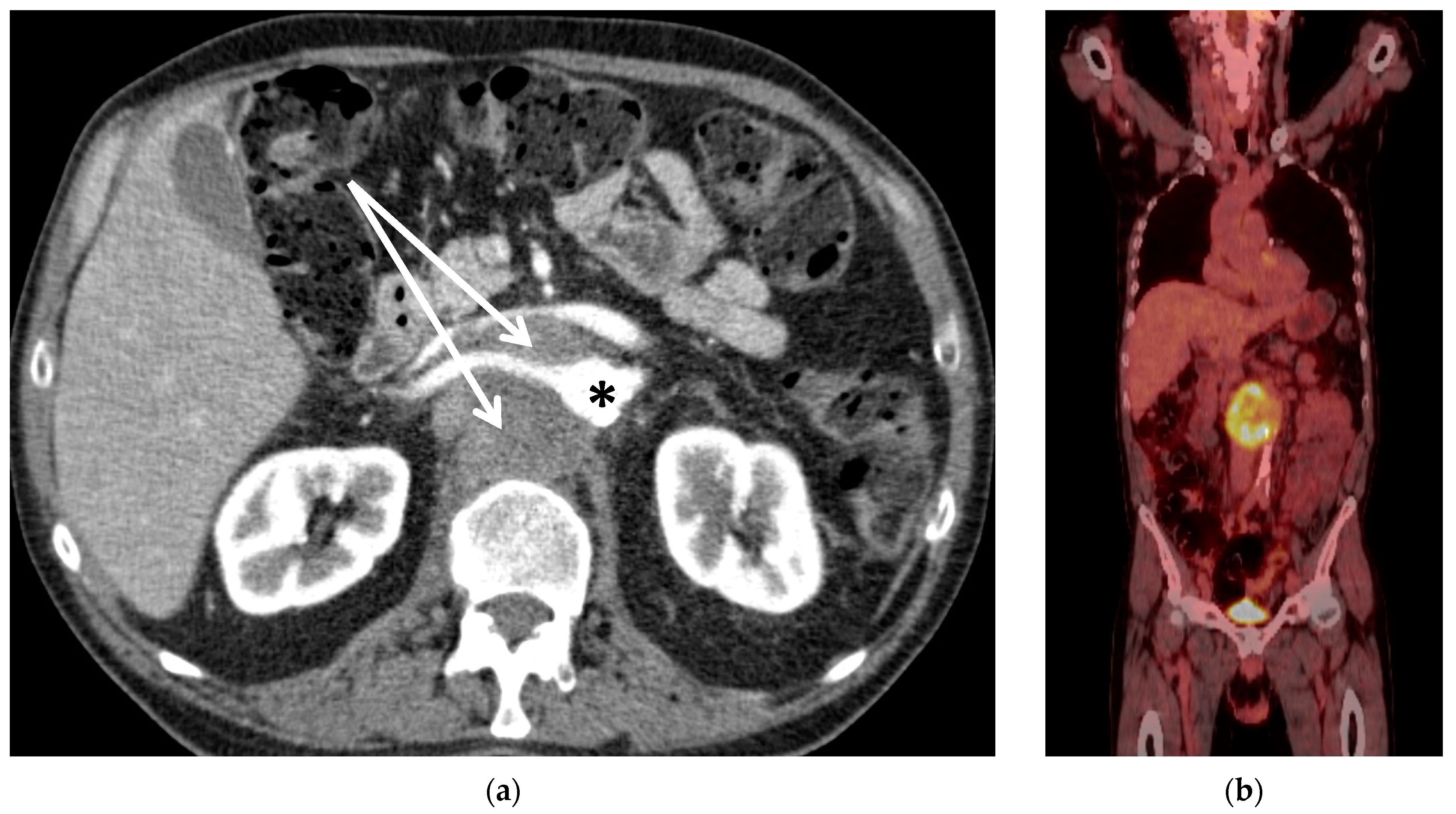 Curroncol 30 00195 g001 Curroncol 30 00195 g001