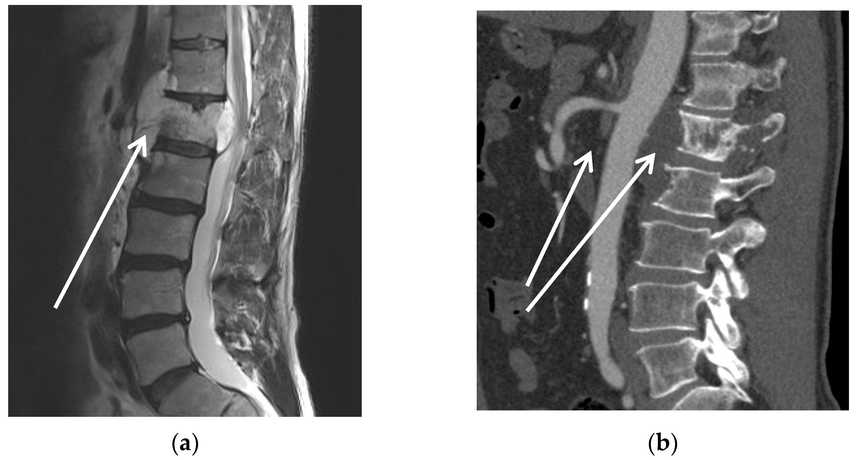 Curroncol 30 00195 g002a Curroncol 30 00195 g002a