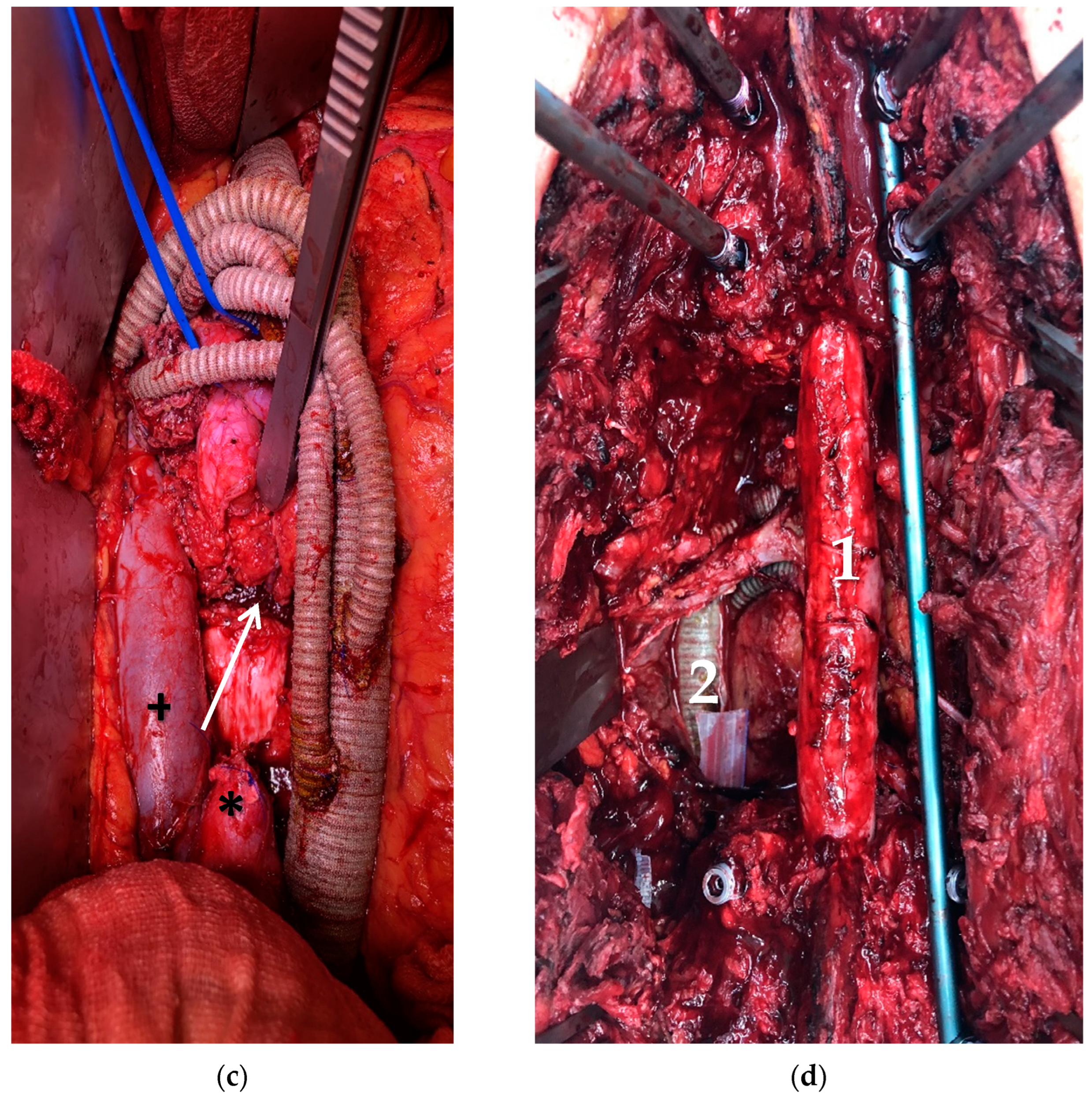Curroncol 30 00195 g002b Curroncol 30 00195 g002b