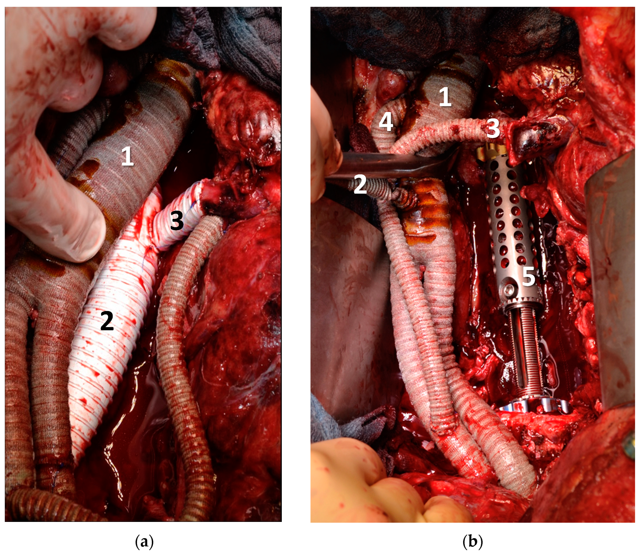 Curroncol 30 00195 g003 Curroncol 30 00195 g003