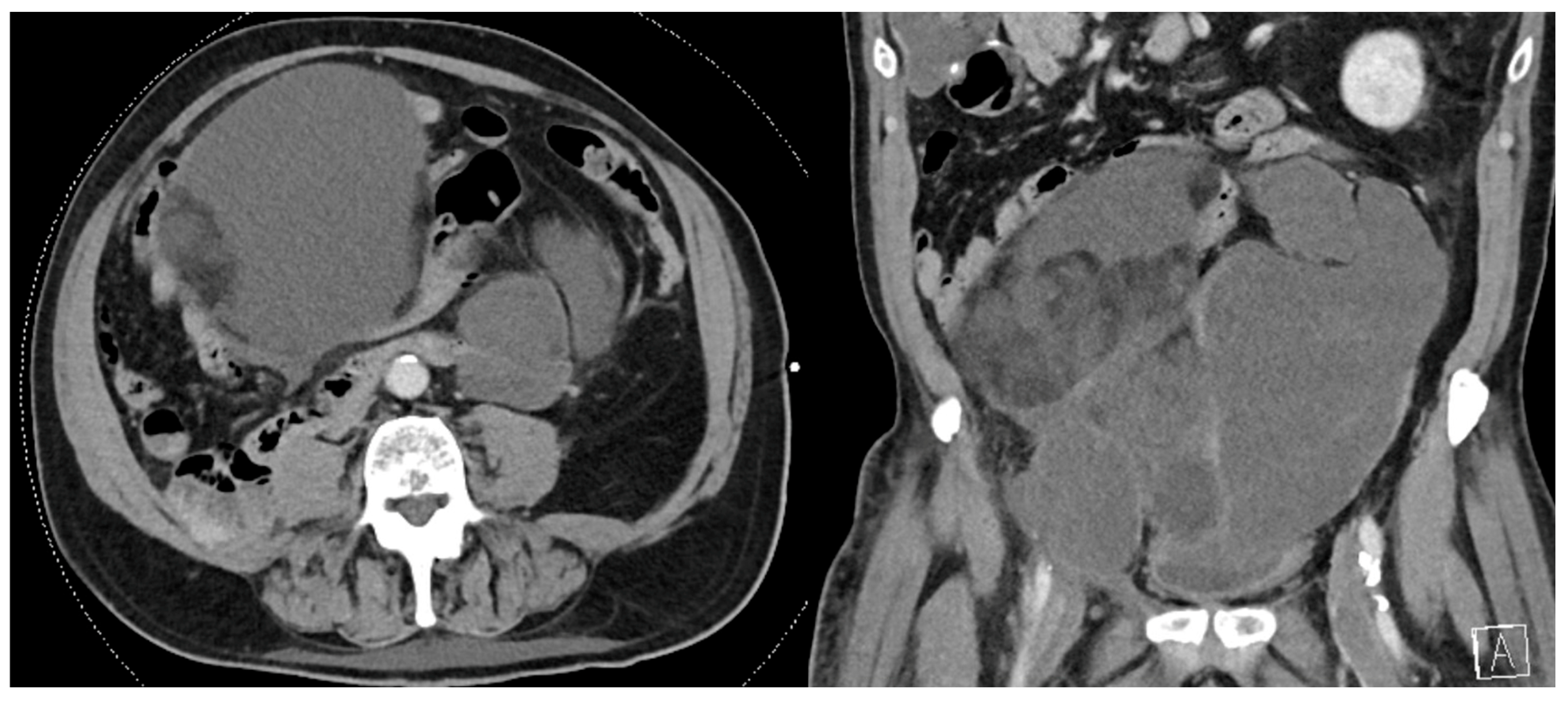 Curroncol 30 00209 g001 Curroncol 30 00209 g001