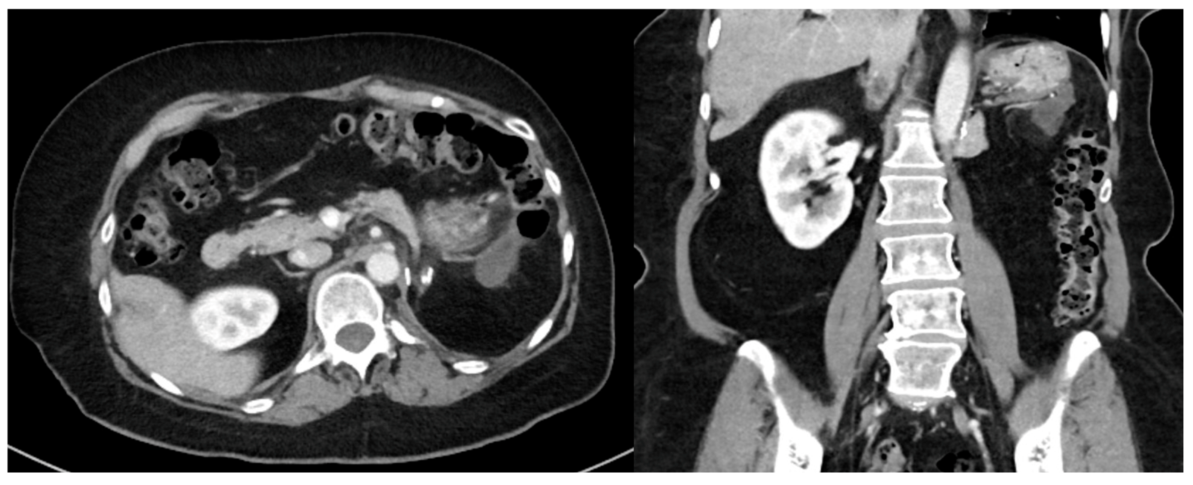 Curroncol 30 00209 g002 Curroncol 30 00209 g002