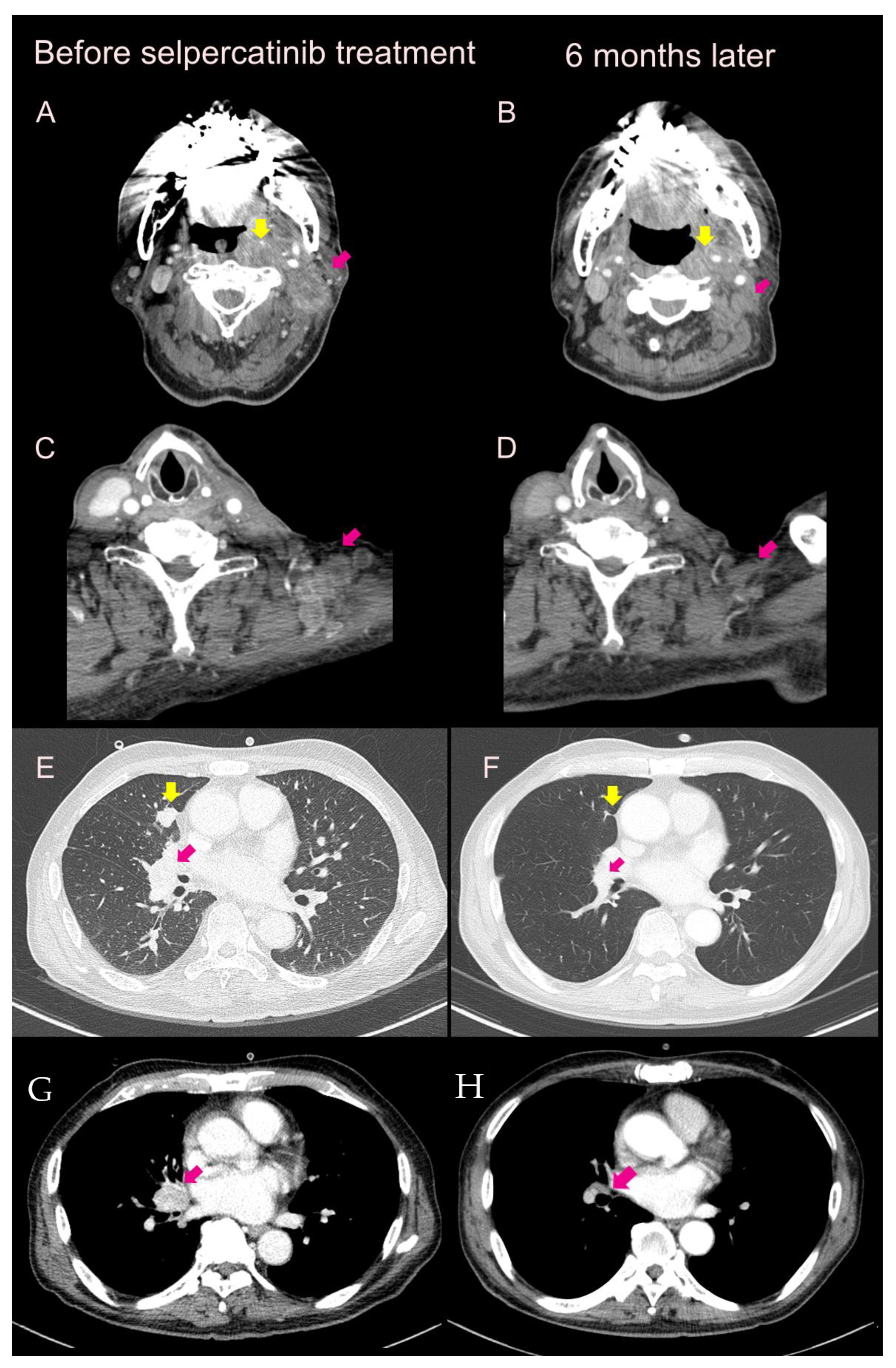Curroncol 30 00229 g001 Curroncol 30 00229 g001