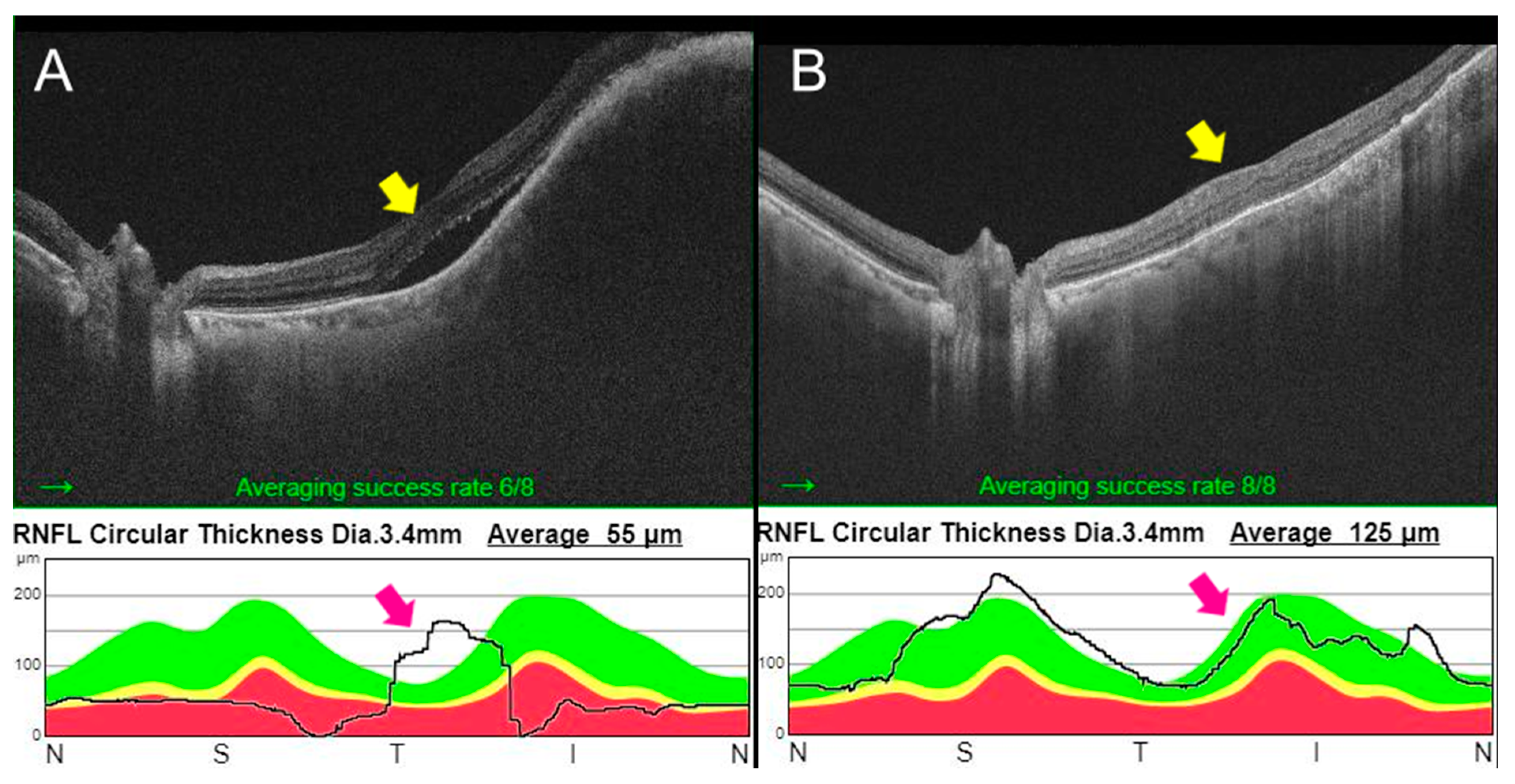 Curroncol 30 00229 g003 Curroncol 30 00229 g003