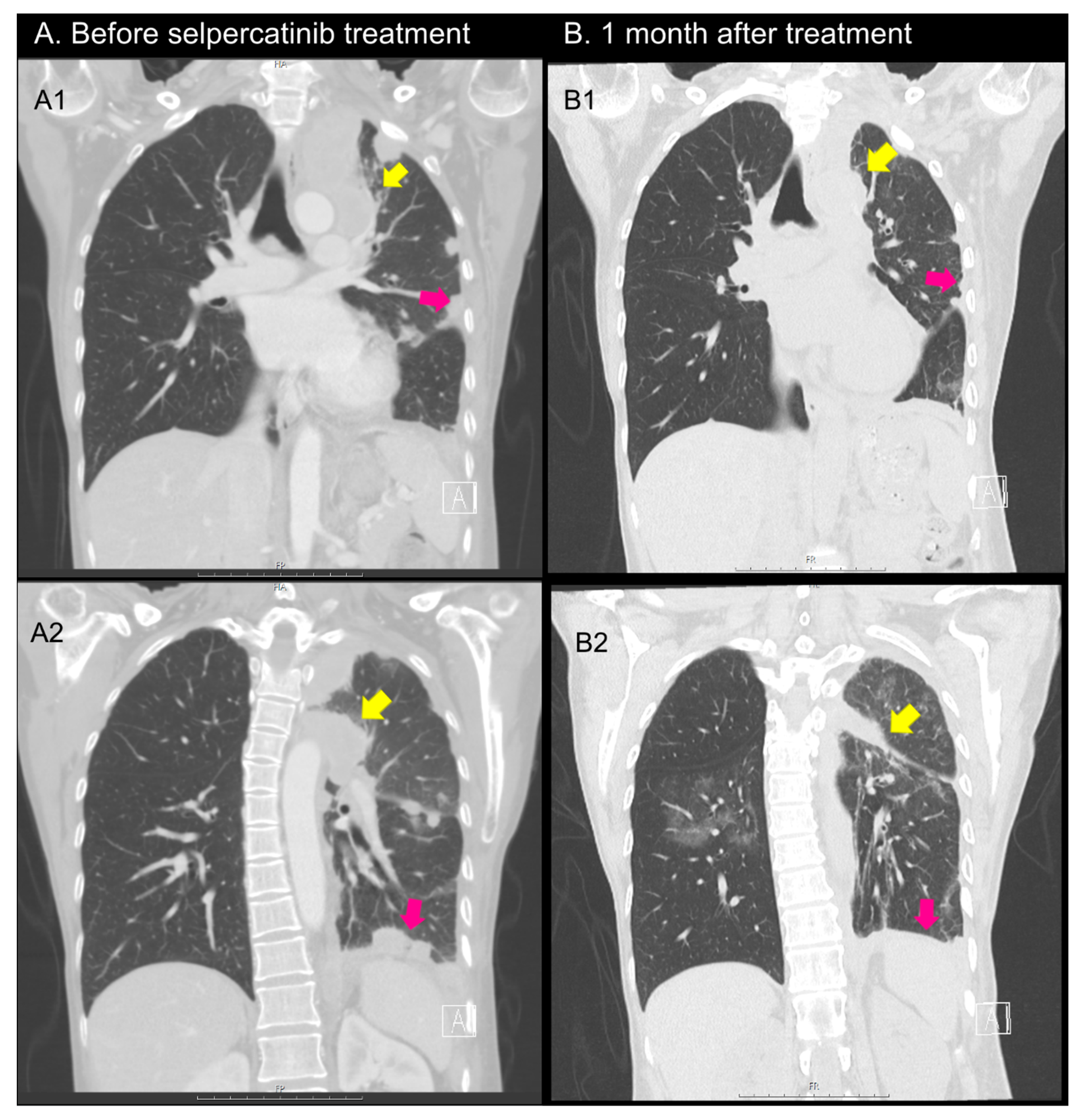 Curroncol 30 00229 g005 Curroncol 30 00229 g005