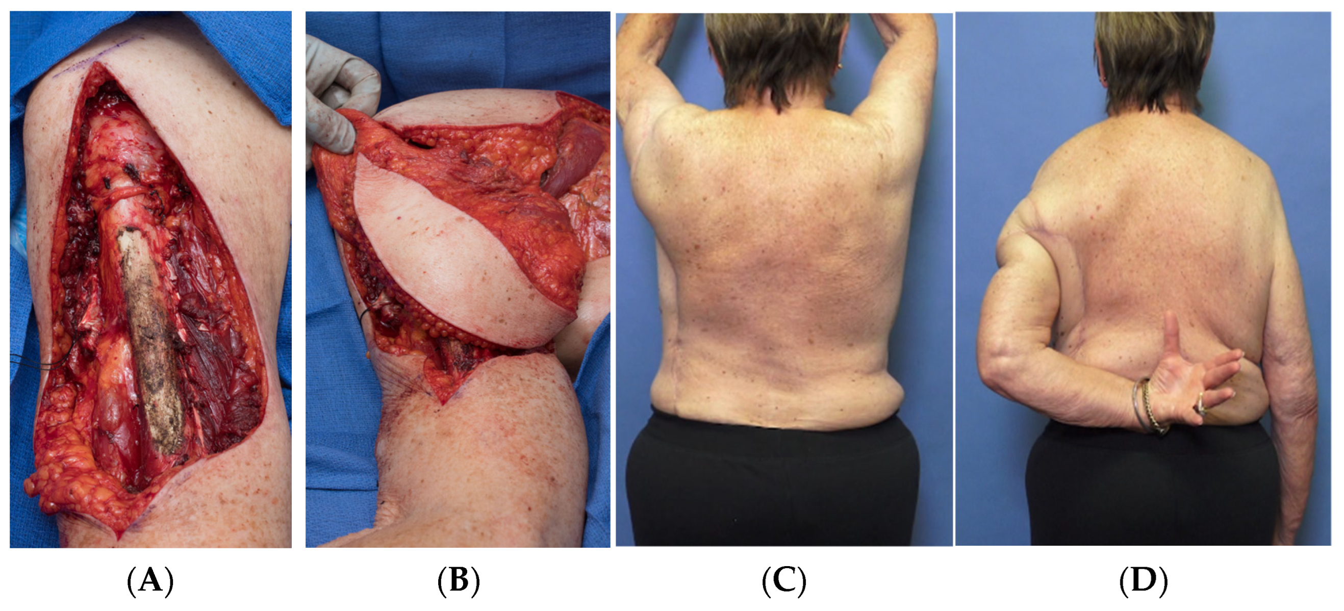 Curroncol 30 00237 g002