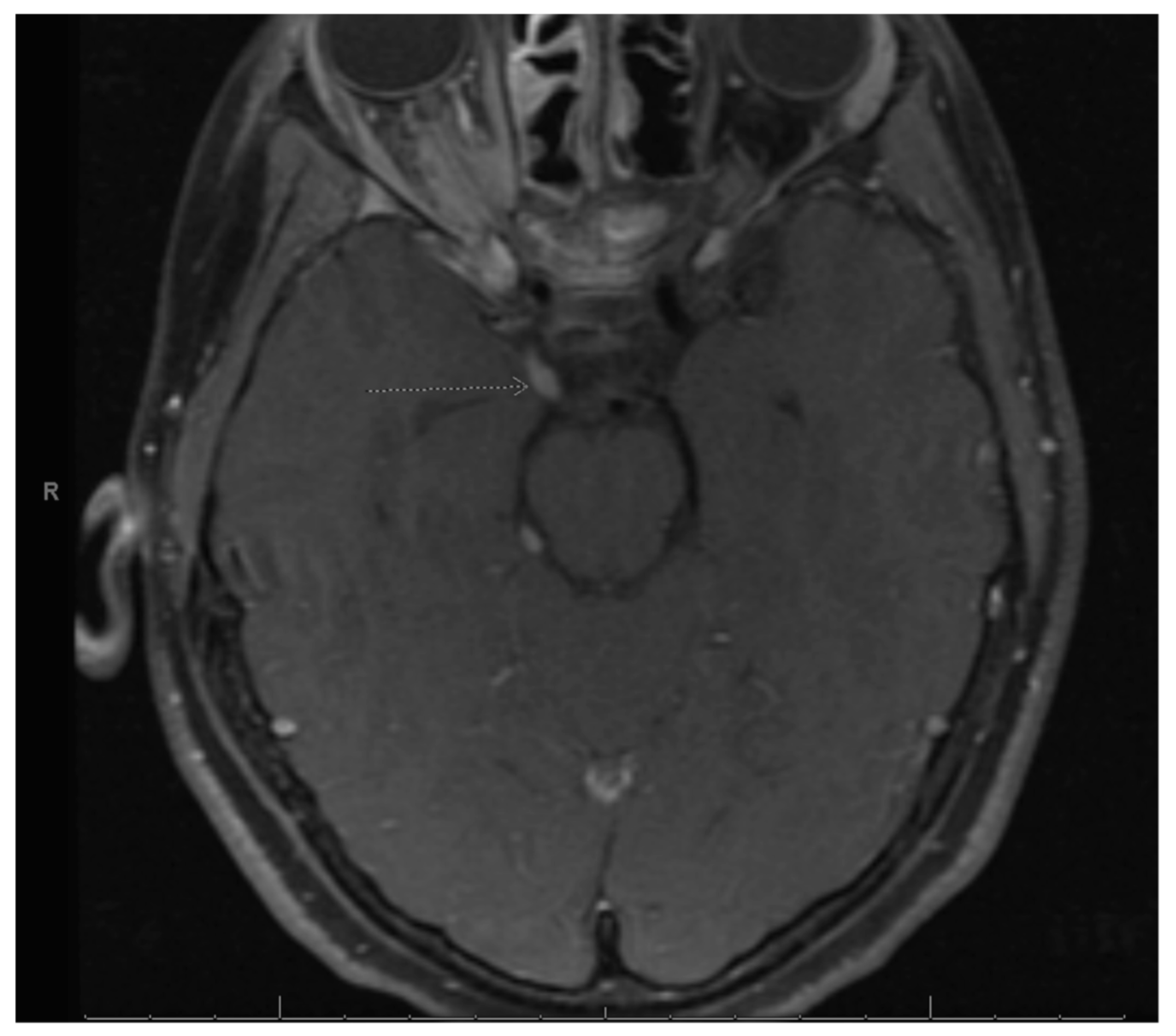 Curroncol 30 00255 g001