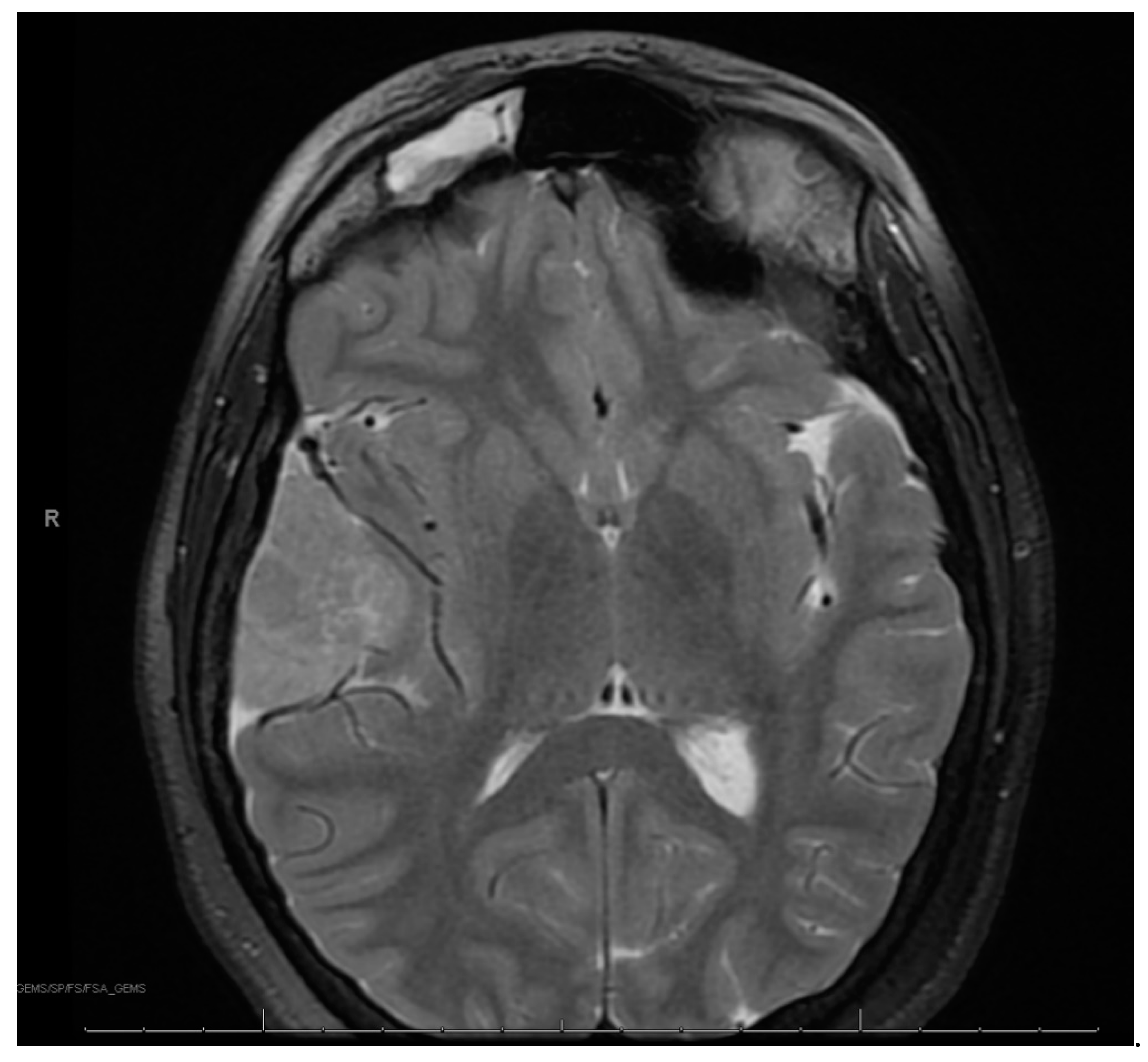 Curroncol 30 00255 g002