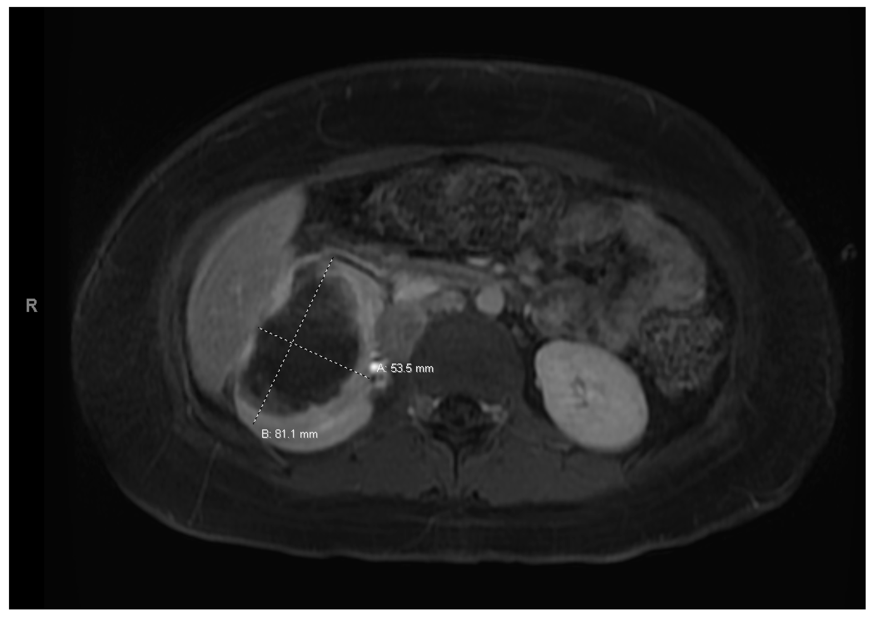 Curroncol 30 00255 g003