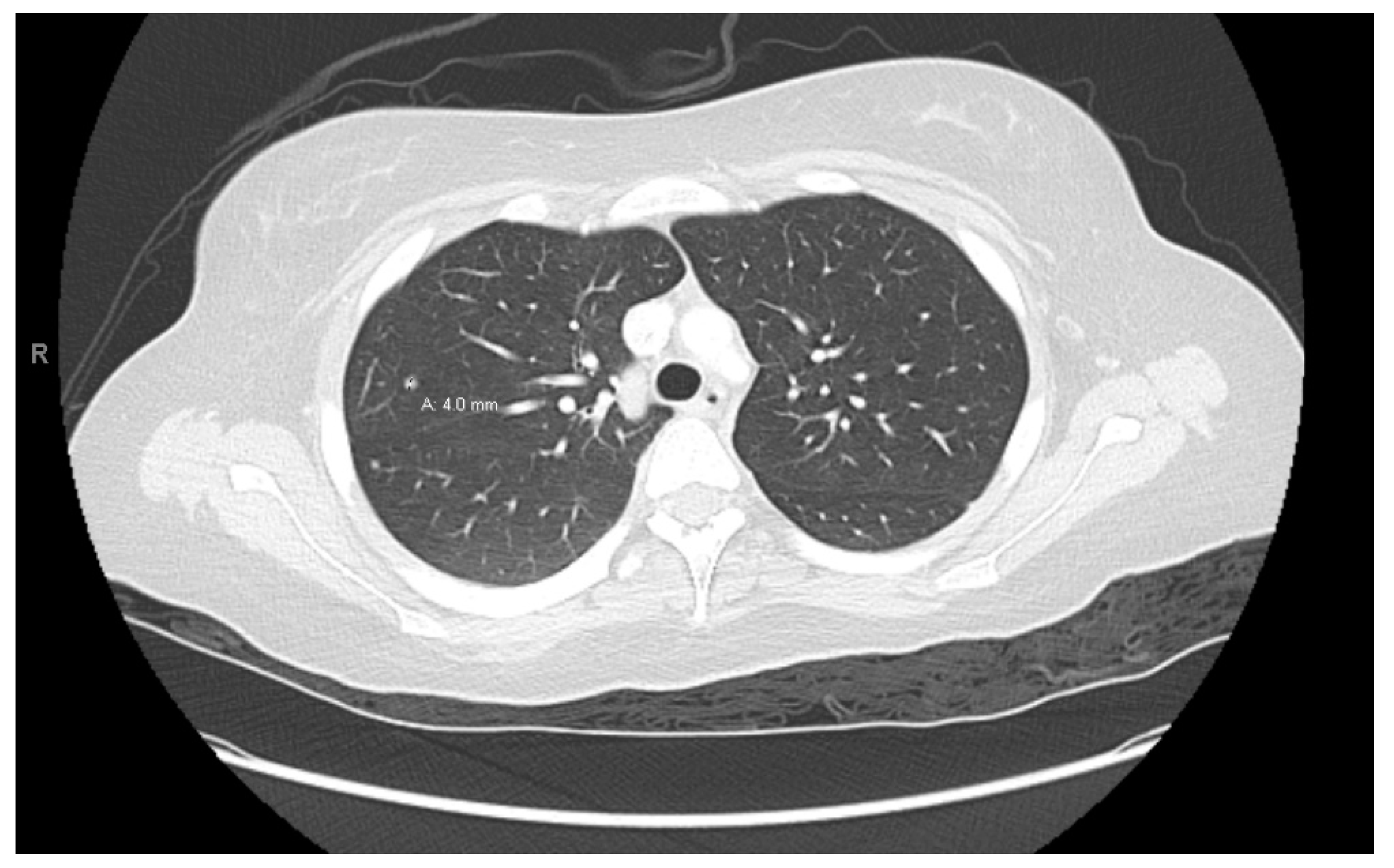 Curroncol 30 00255 g005