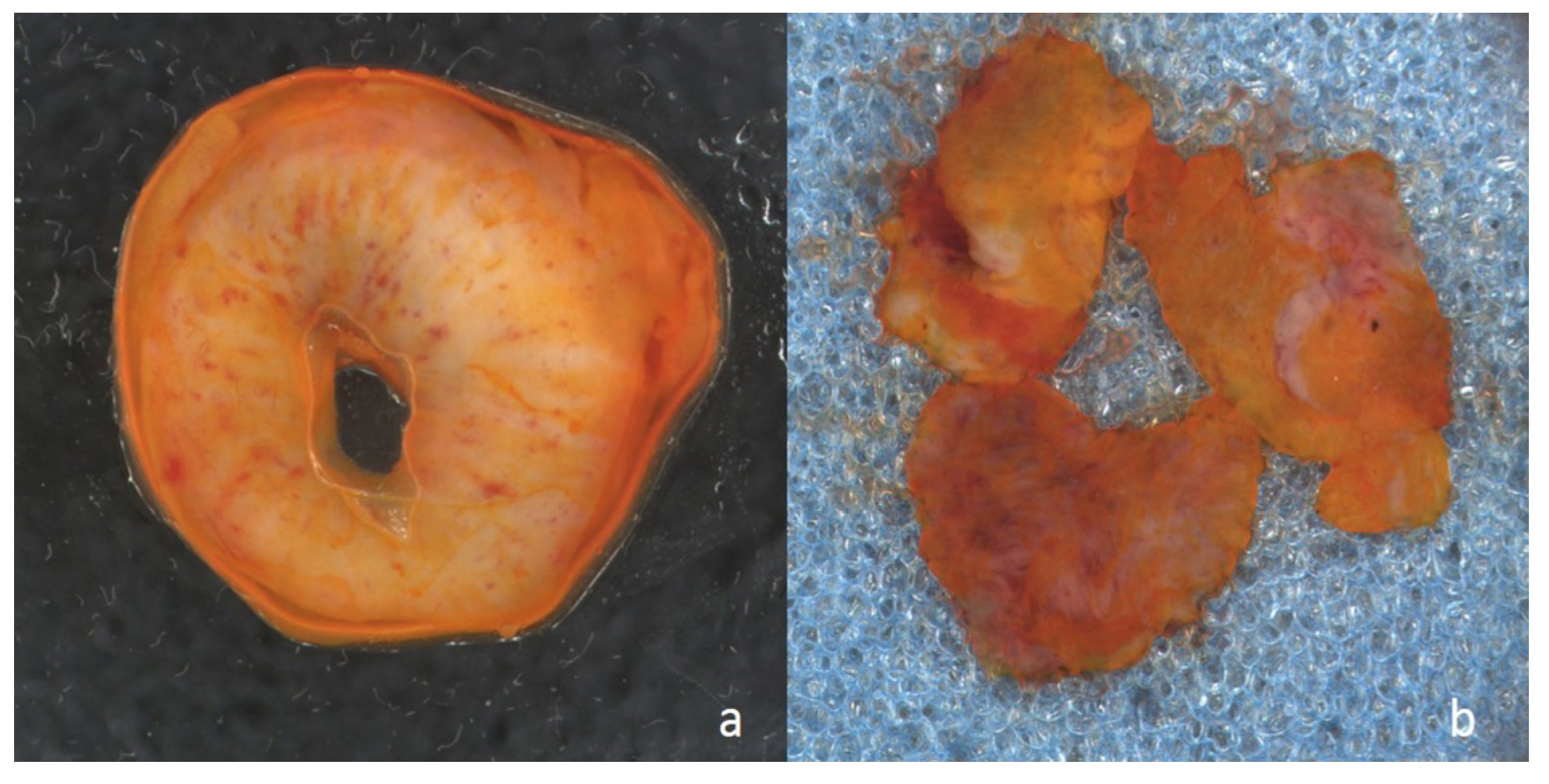 Curroncol 30 00259 g001 Curroncol 30 00259 g001