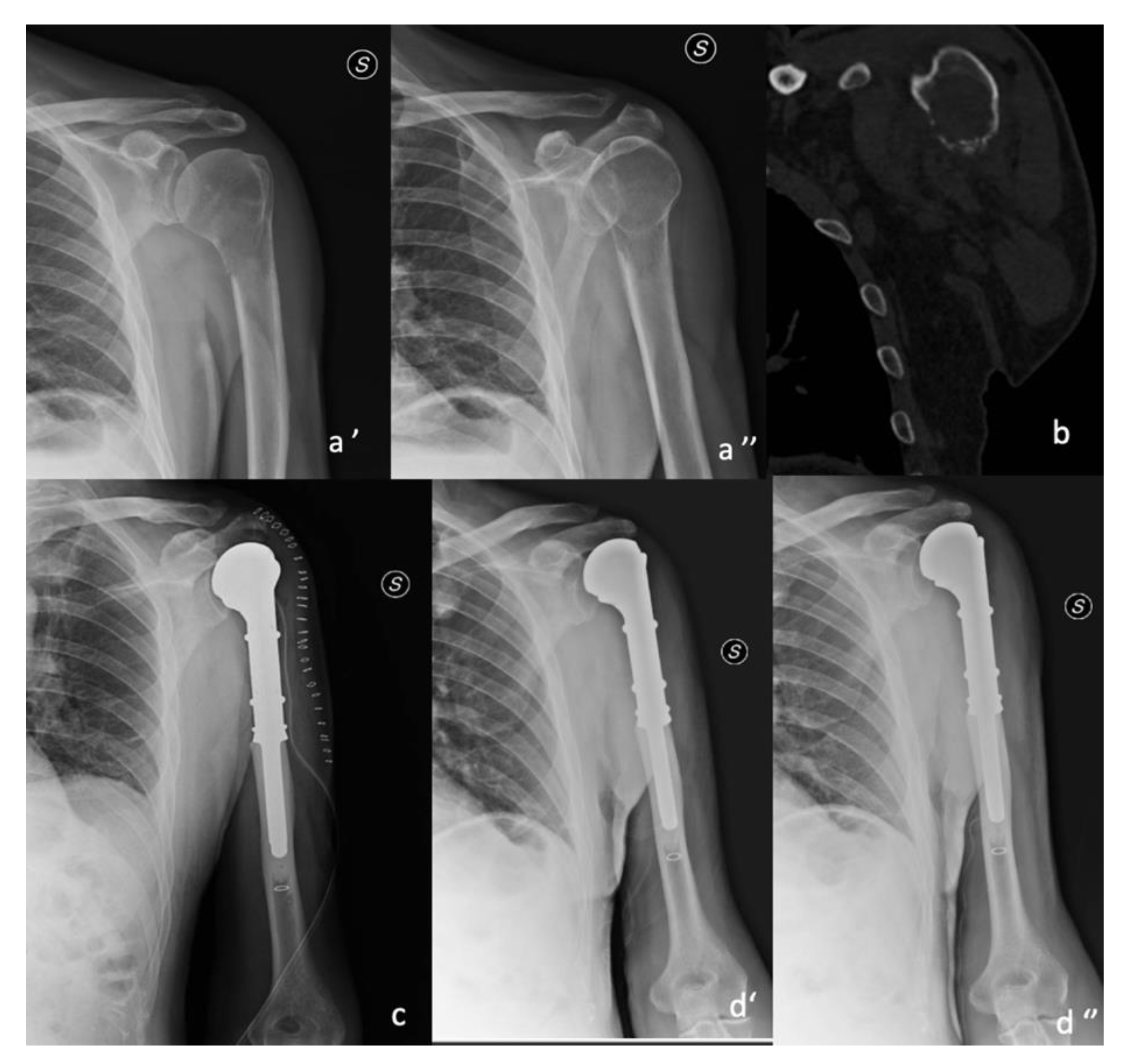 Curroncol 30 00272 g001 Curroncol 30 00272 g001