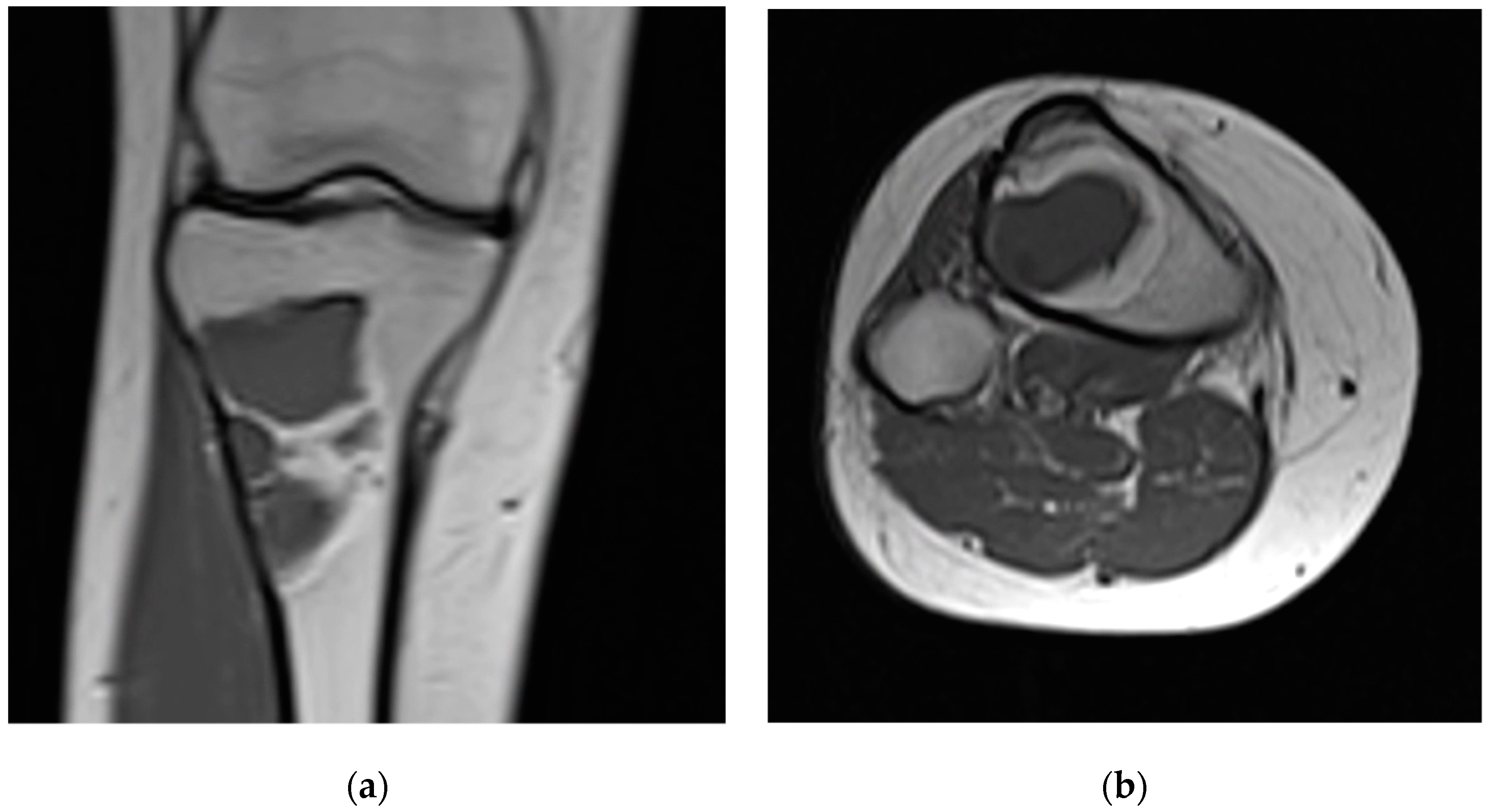 Curroncol 30 00281 g002a Curroncol 30 00281 g002a