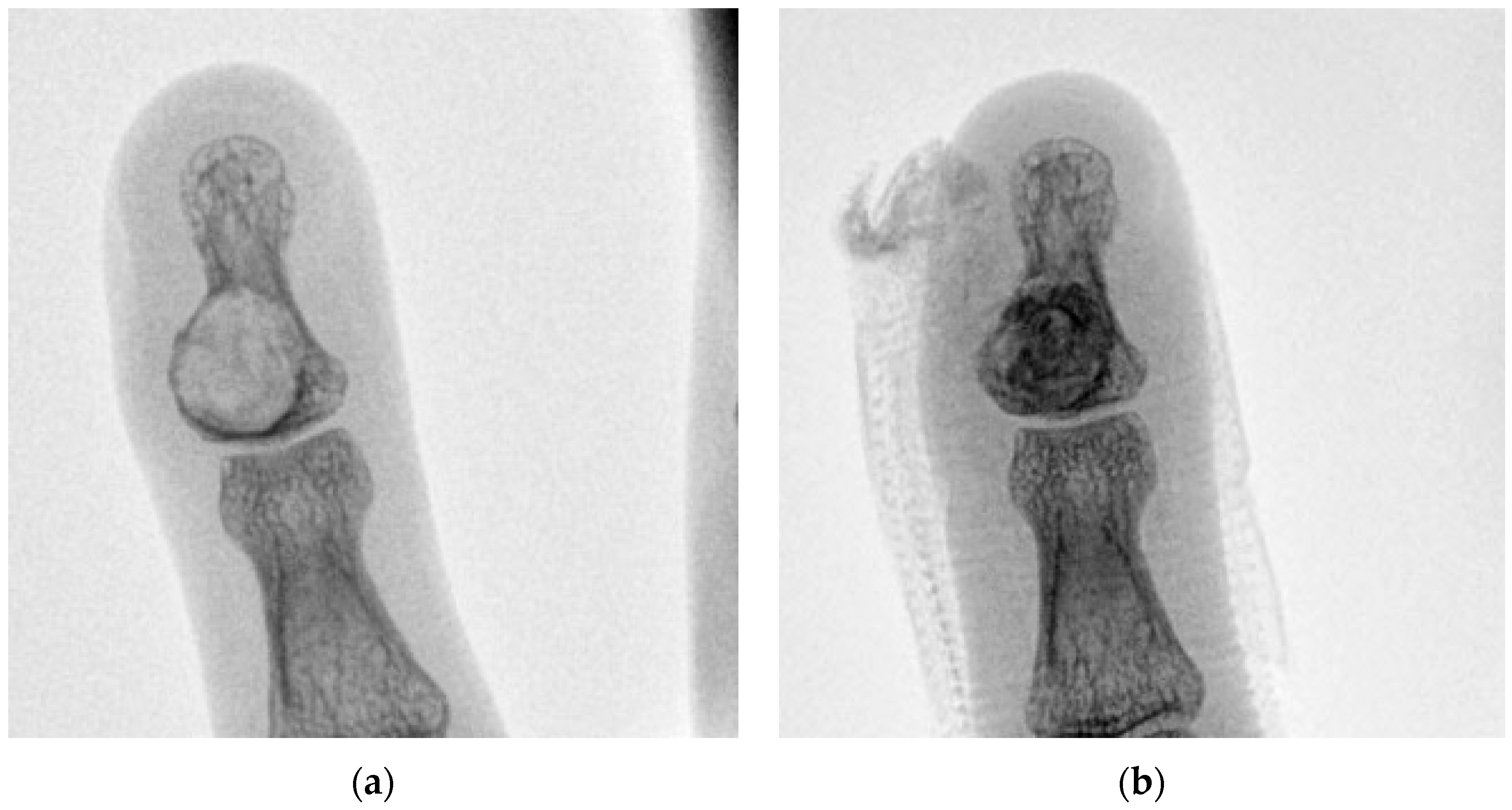 Curroncol 30 00281 g003a Curroncol 30 00281 g003a