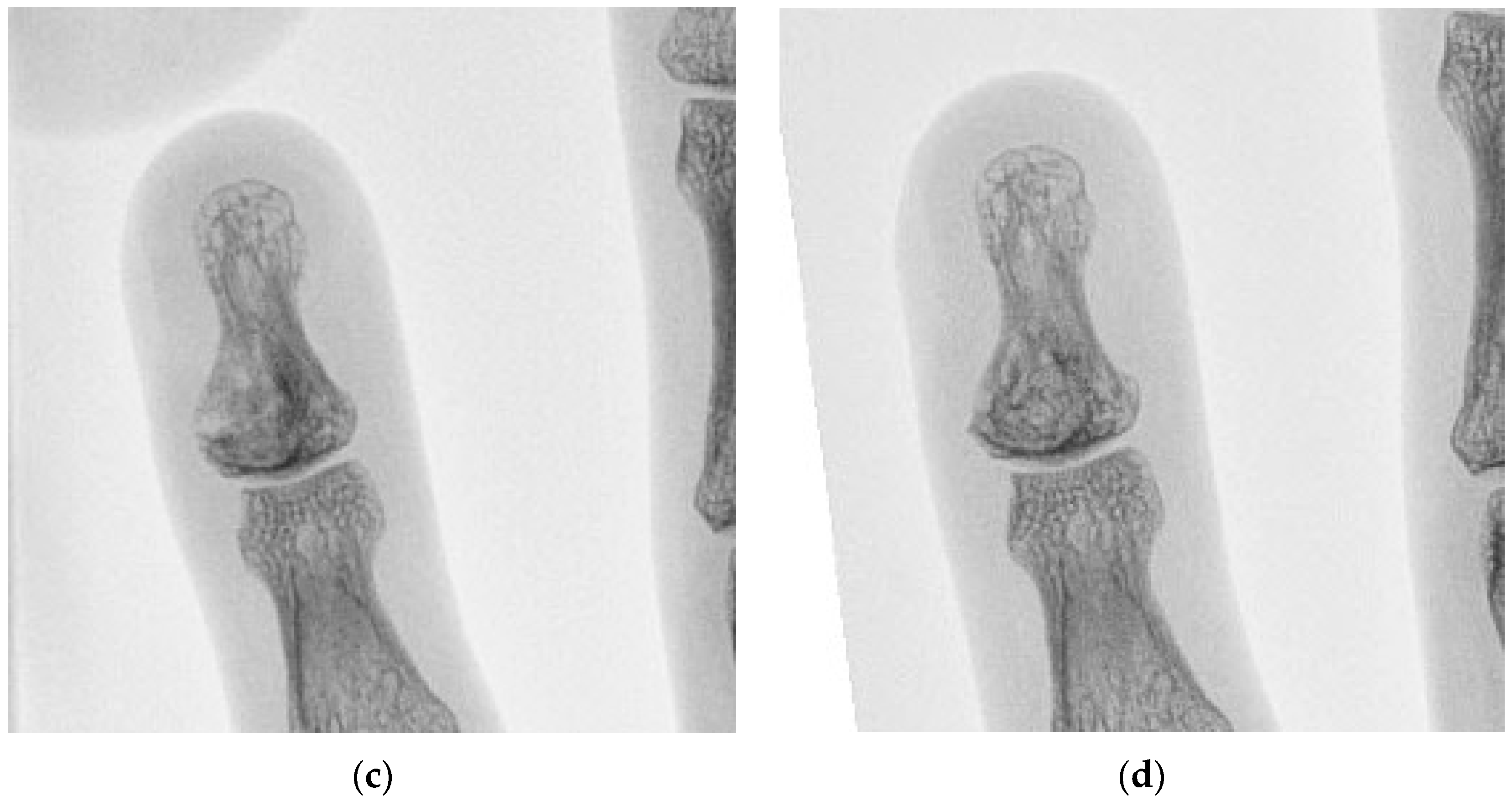 Curroncol 30 00281 g003b Curroncol 30 00281 g003b