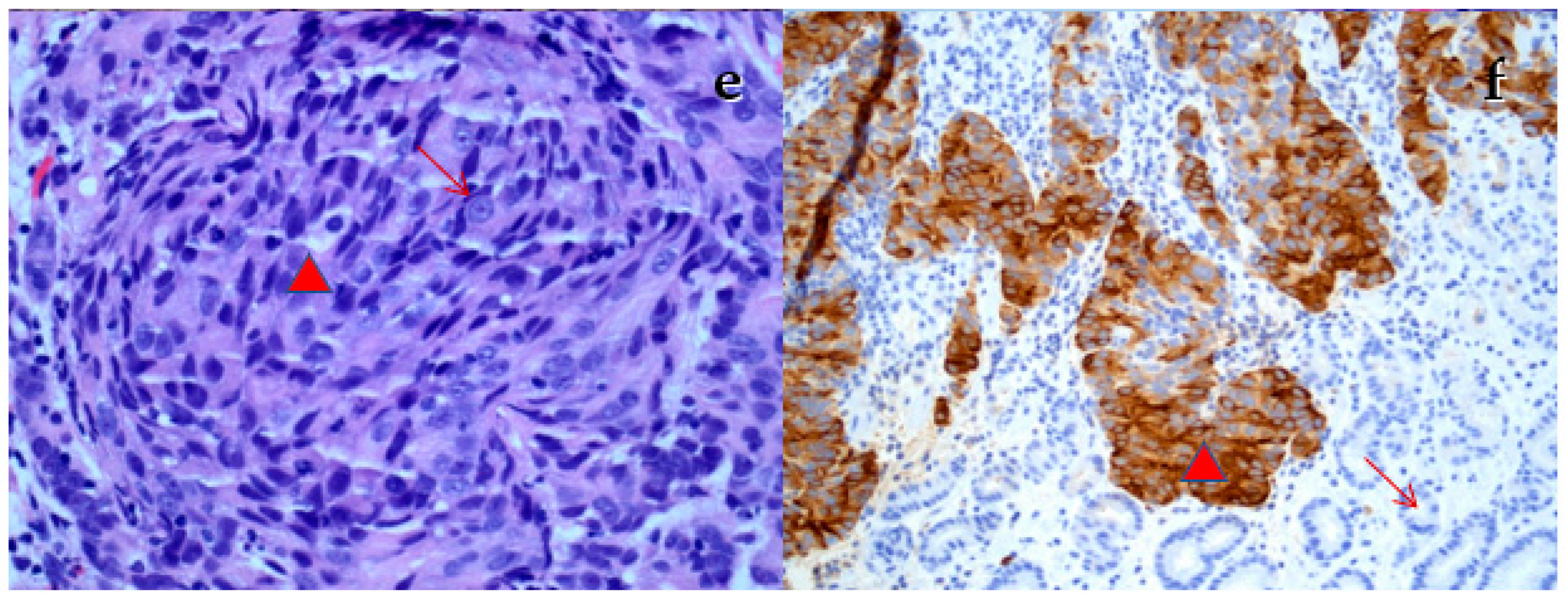 Curroncol 30 00295 g002b Curroncol 30 00295 g002b