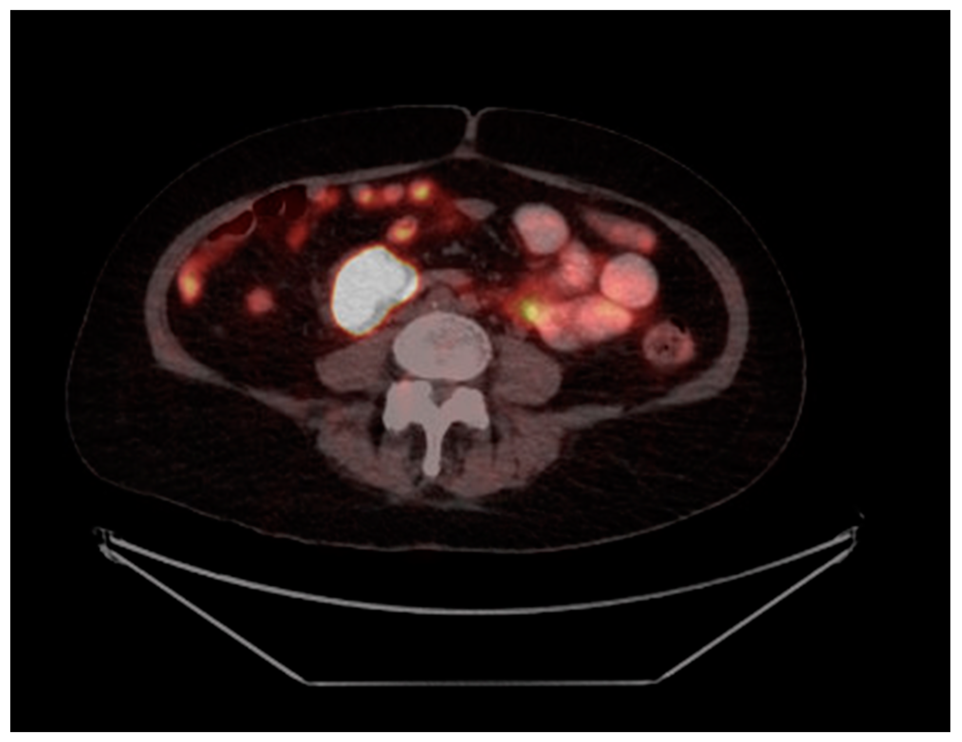 Curroncol 30 00312 g001 Curroncol 30 00312 g001