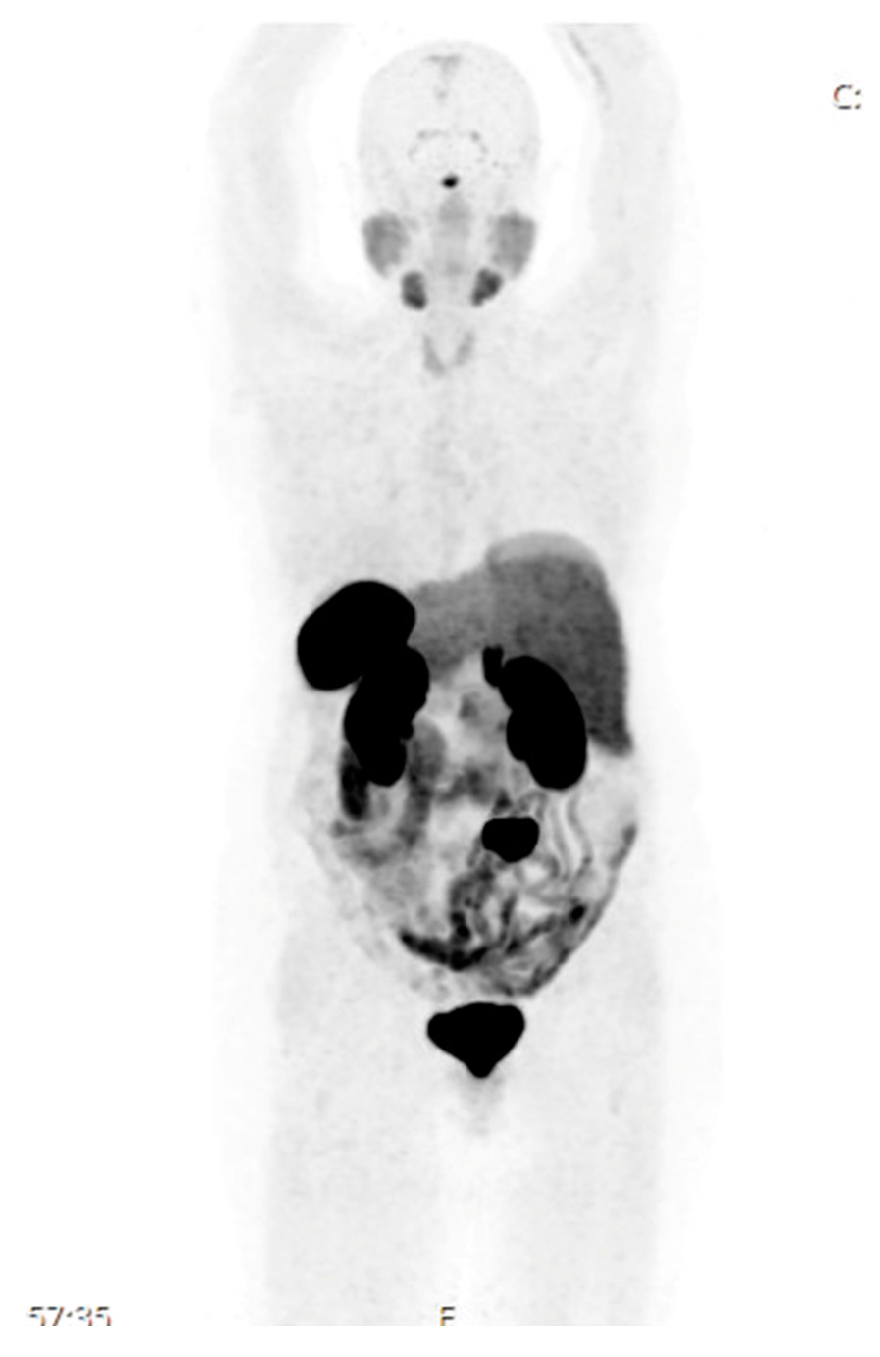 Curroncol 30 00312 g002 Curroncol 30 00312 g002