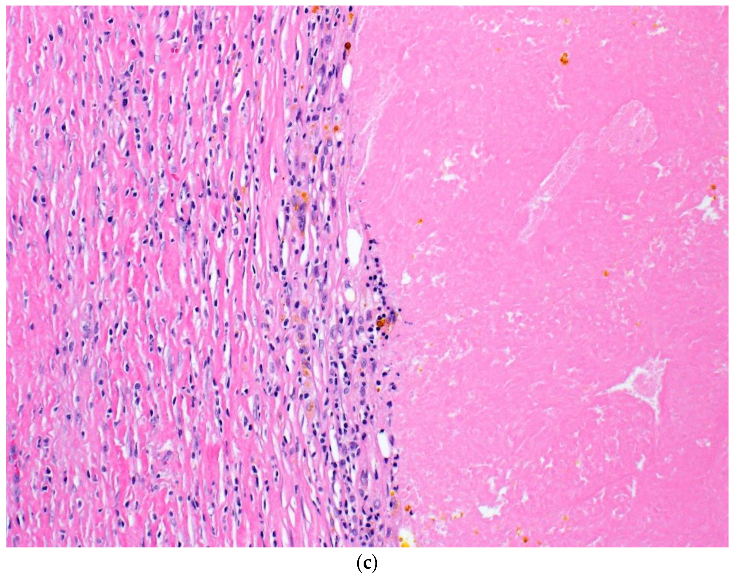 Curroncol 30 00335 g002b