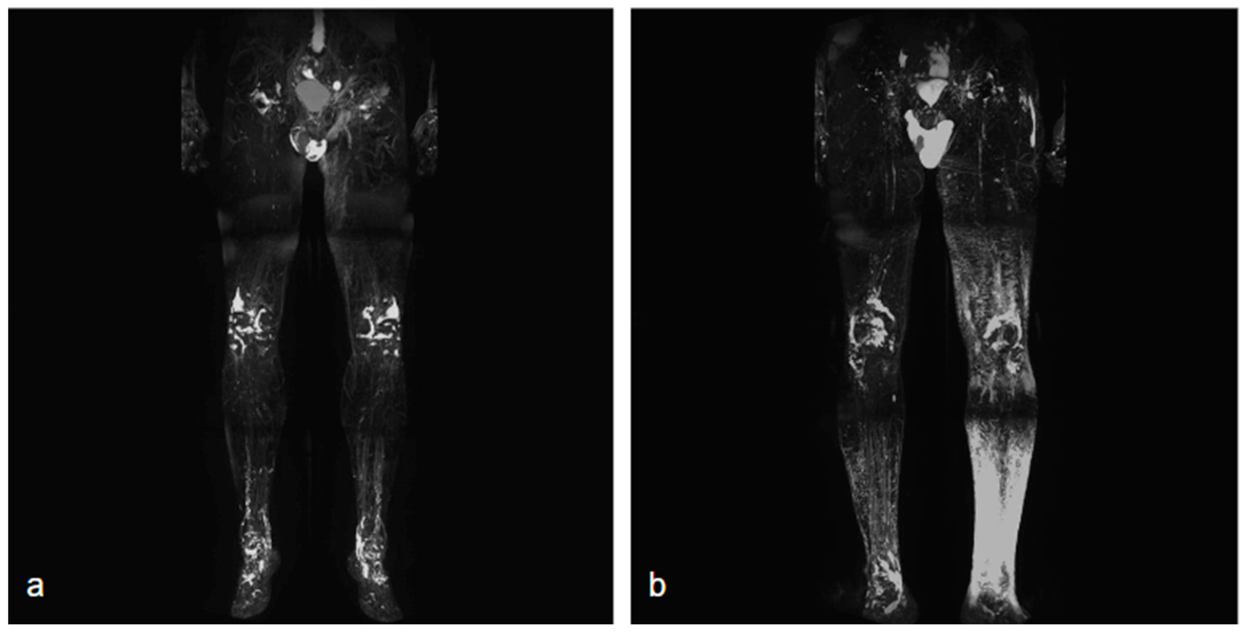 Curroncol 30 00341 g001 Curroncol 30 00341 g001