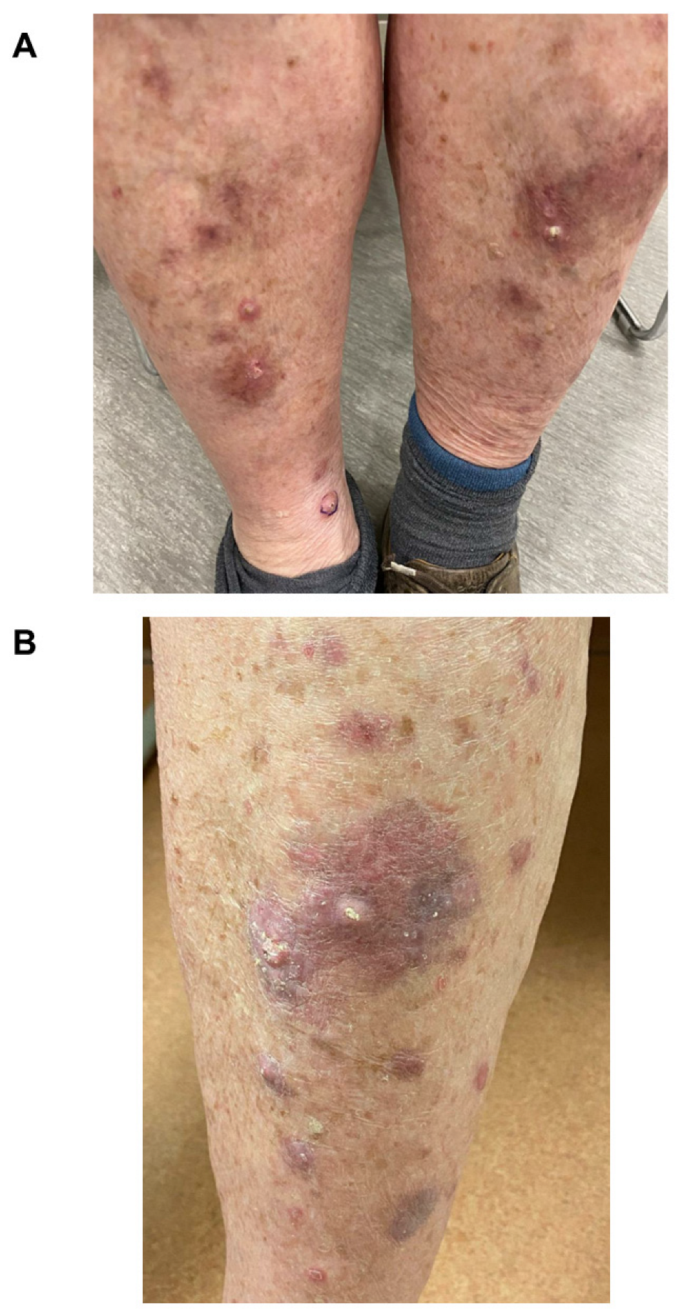 Curroncol 30 00342 g002 Curroncol 30 00342 g002