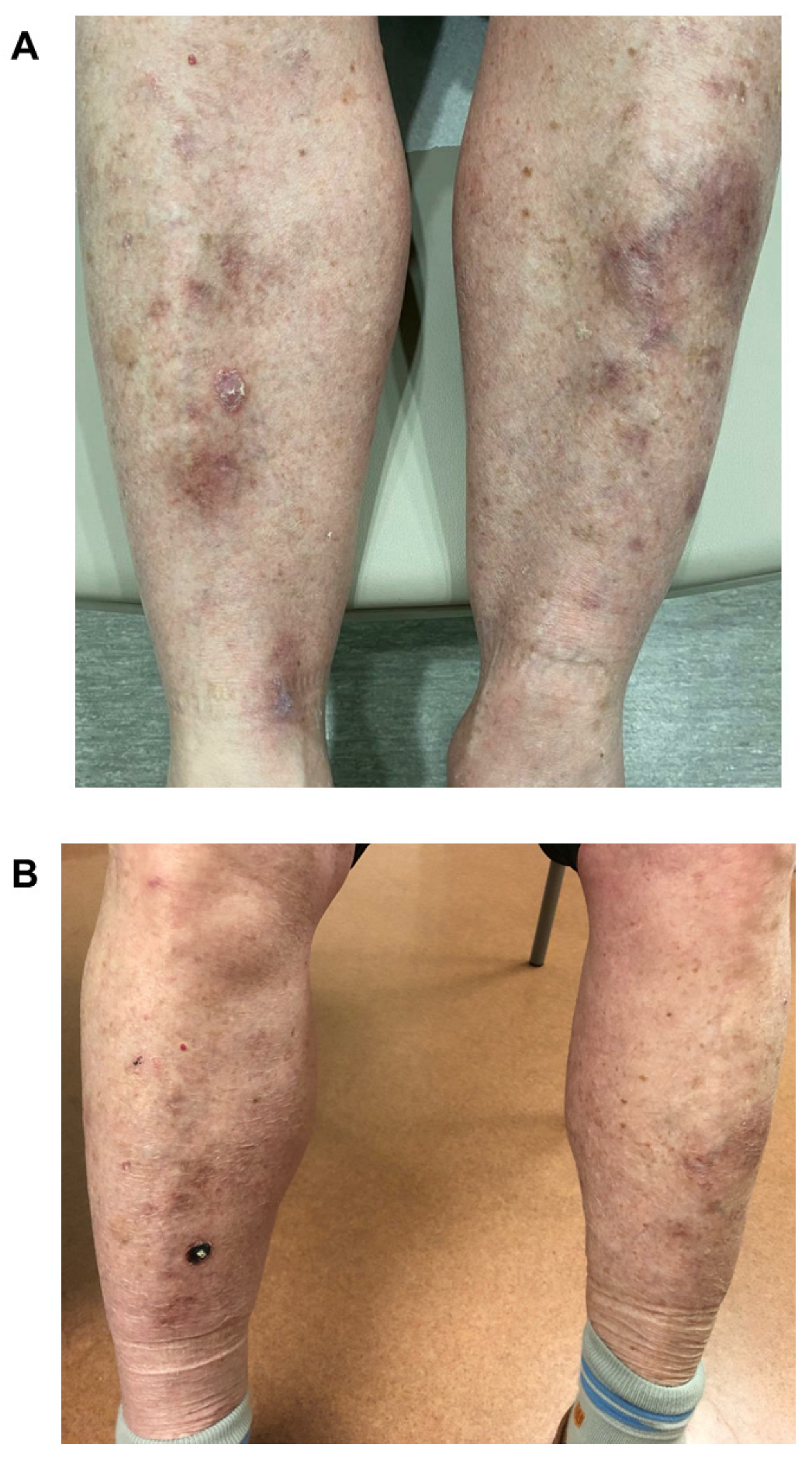 Curroncol 30 00342 g003 Curroncol 30 00342 g003