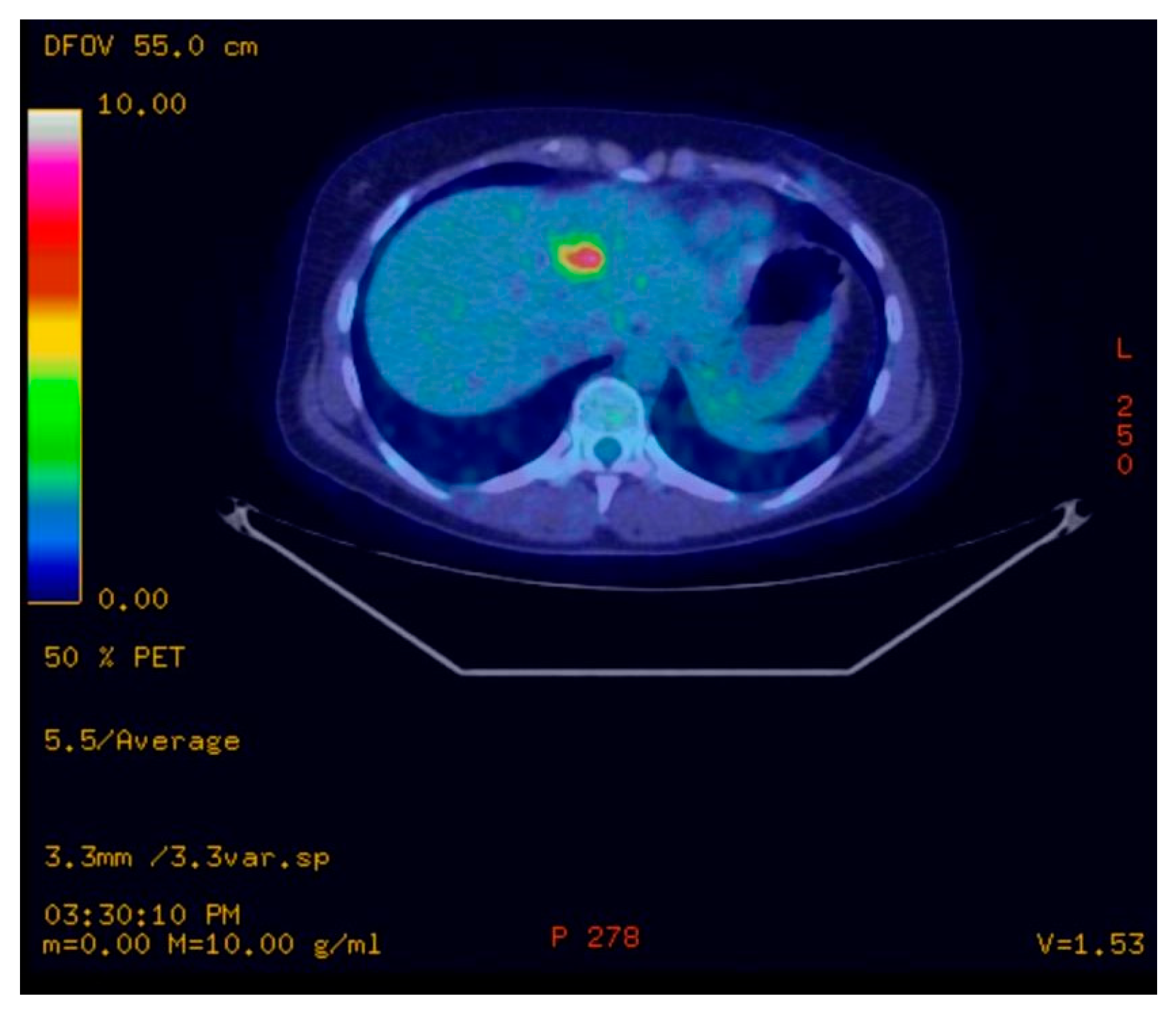 Curroncol 30 00364 g003